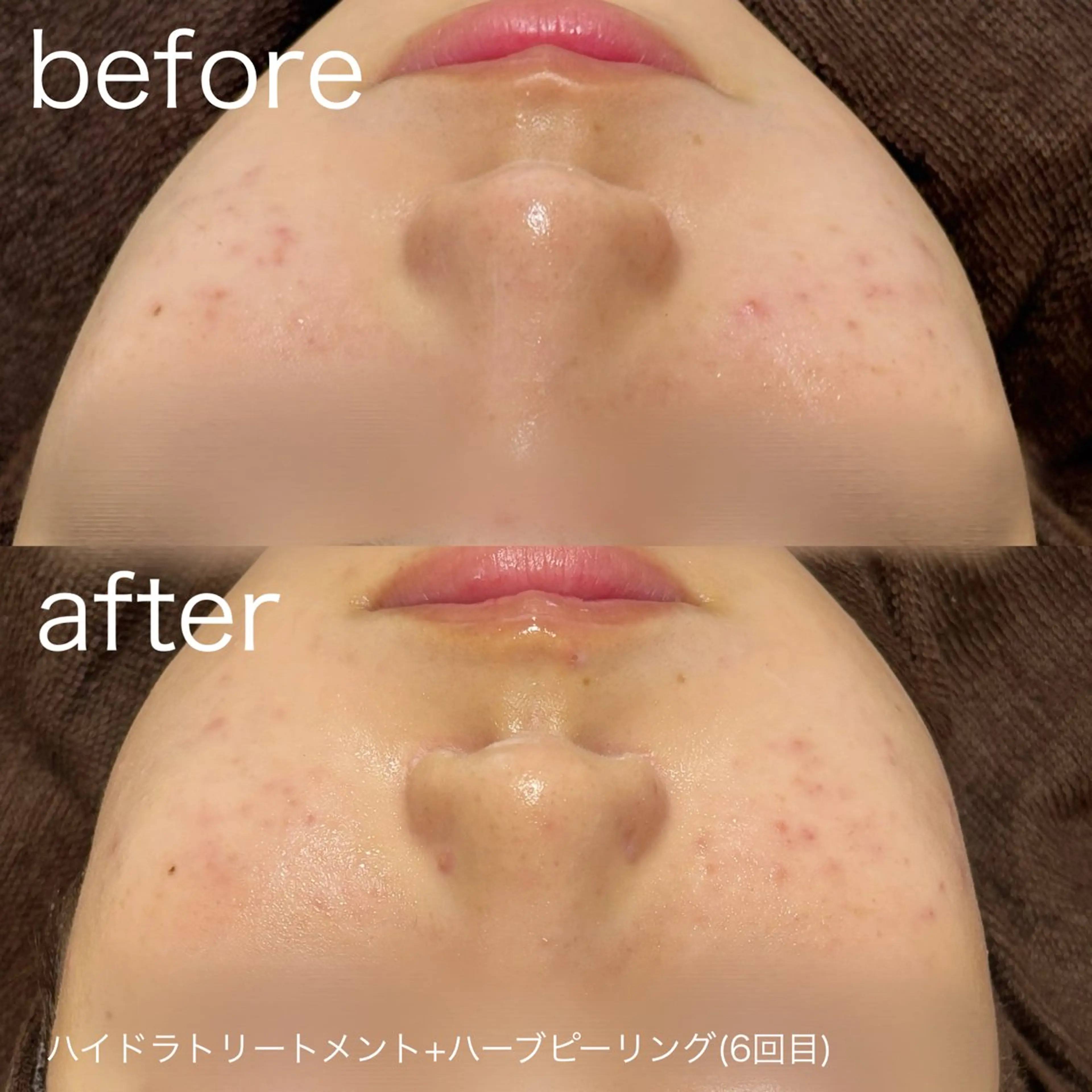 脱毛 lulularico Yuのエステ・リラクイメージ