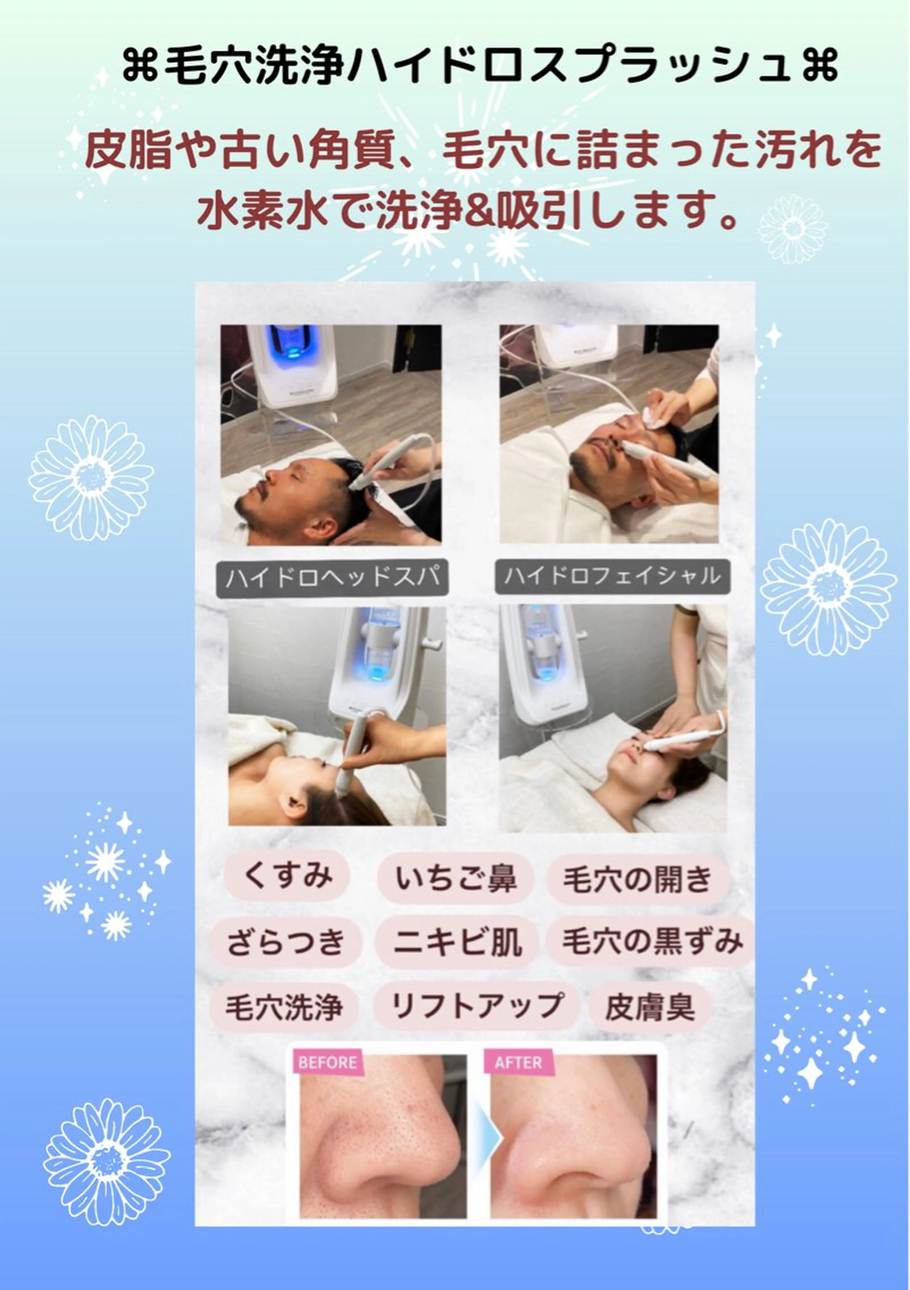 初回お試し価格　　　　　　　　　　　　　　　　　　　フェイス毛穴洗浄（パック付）ハイドロスプラッシュ✨の写真