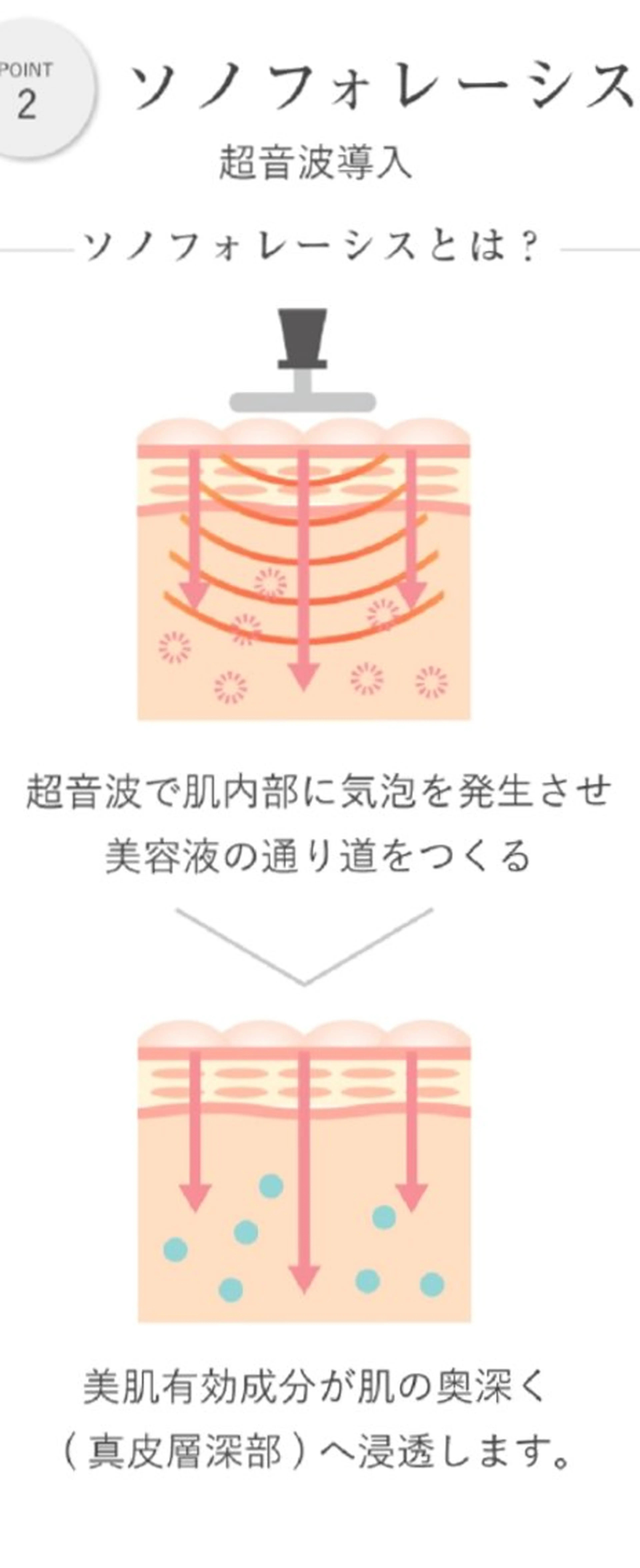 アクアダーマ（エクソソーム）メニューの写真