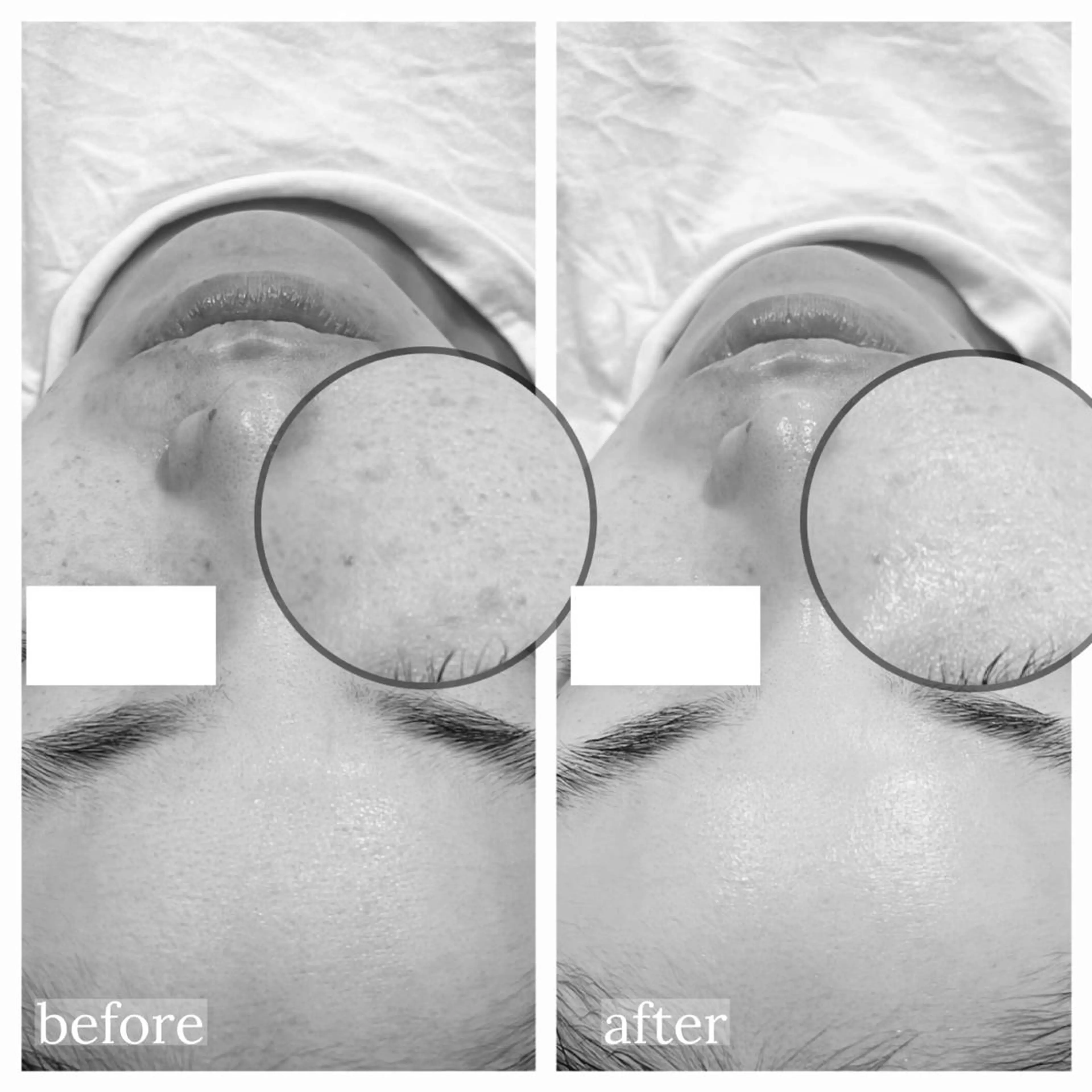 エステ tejina suuのエステ・リラクイメージ