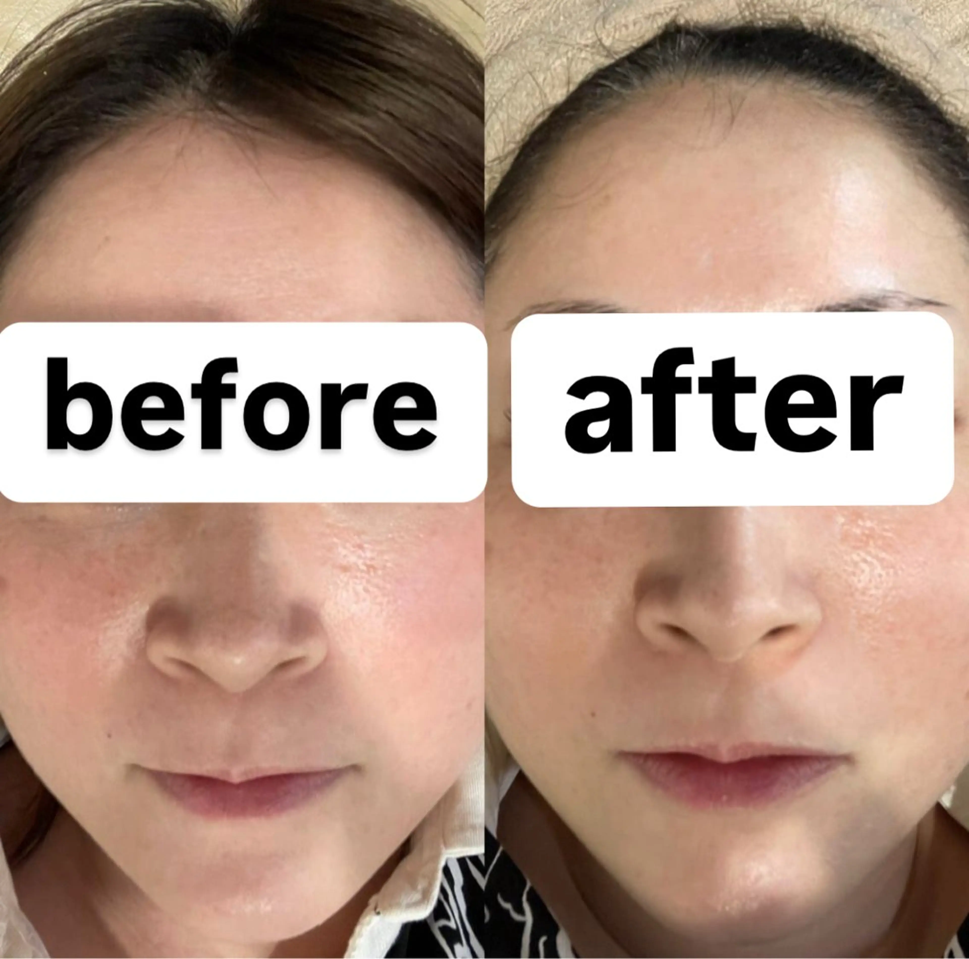 エステ Shiny所属・✨ナリス化粧品✨ Shinyのエステ・リラクイメージ