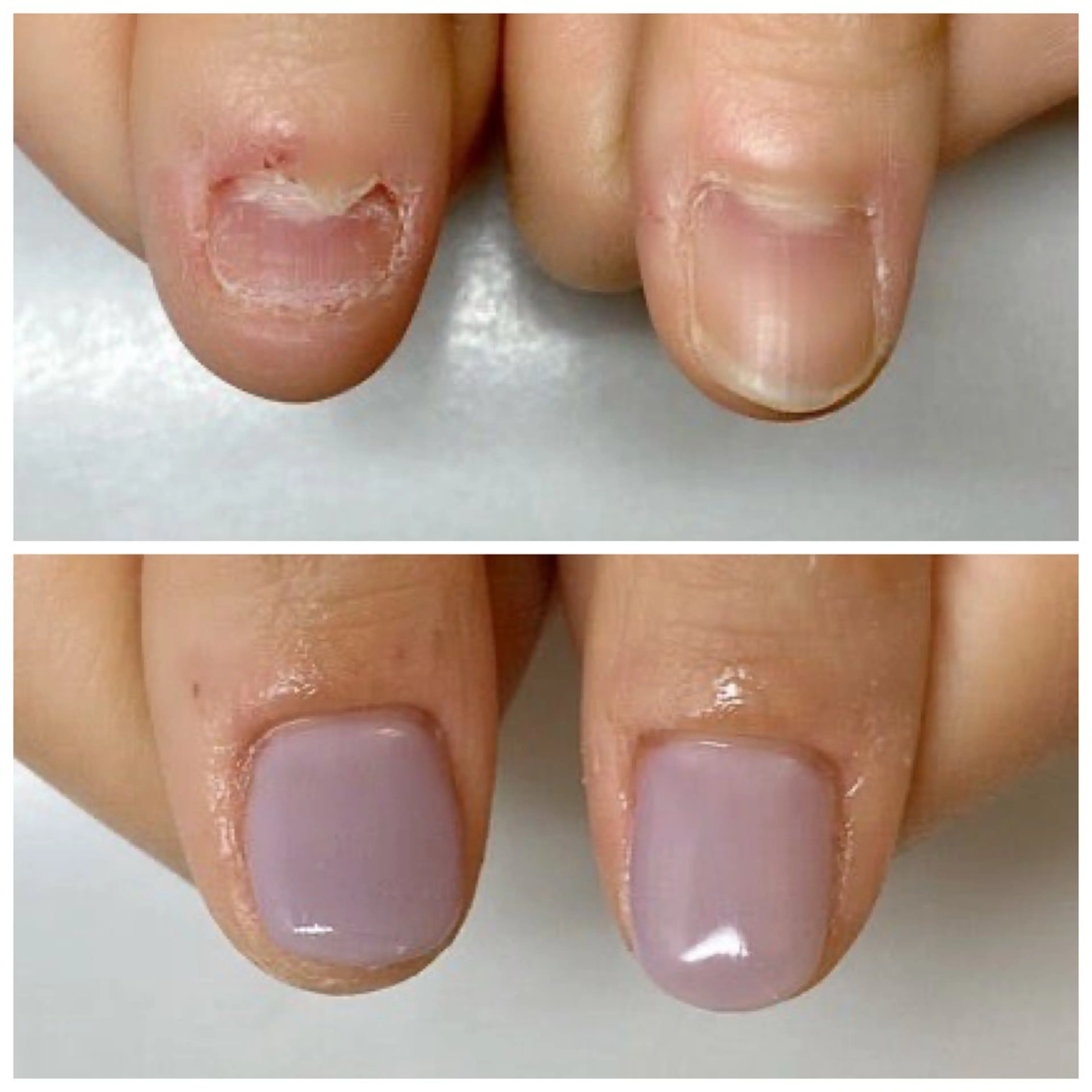 ネイル ネイルサロン アリュームのネイルデザイン