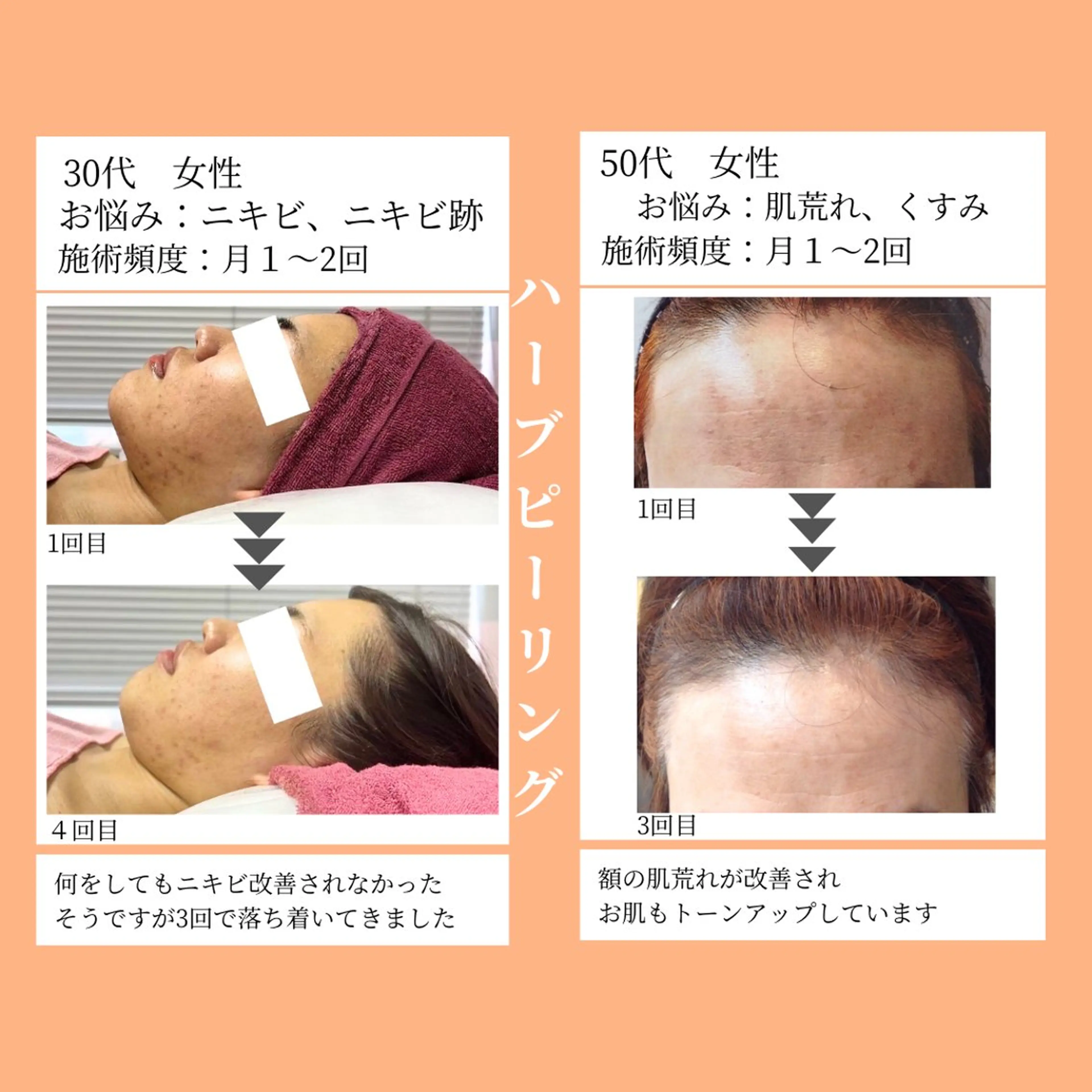 小顔・ツルツル素肌 ハリステリアのエステ・リラクイメージ