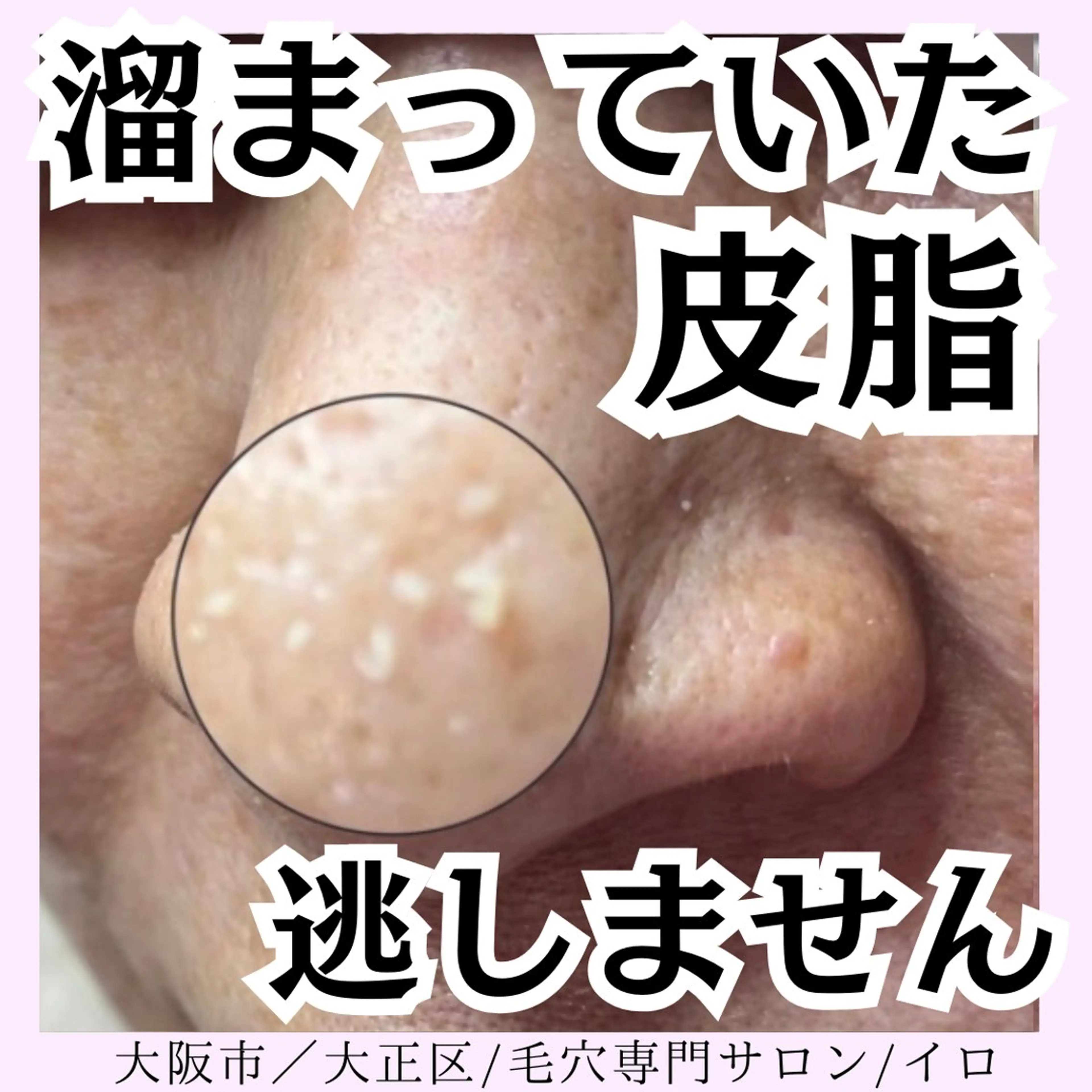 IRO KANAのマツエク・マツパデザイン