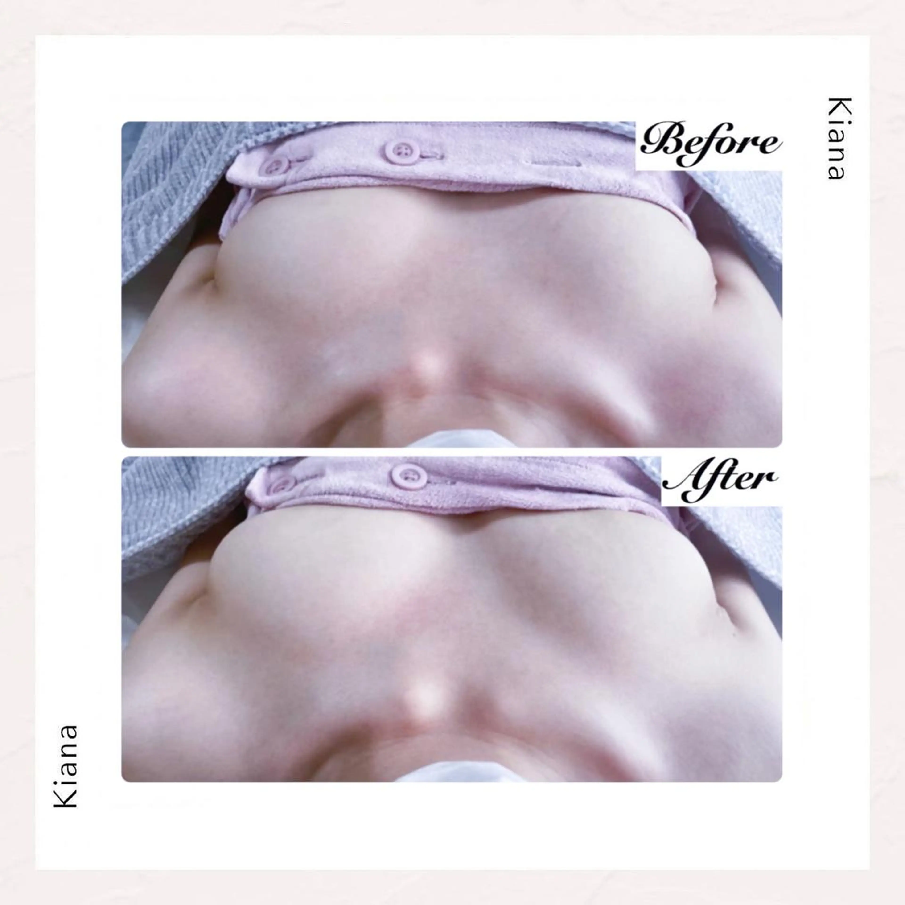 エステ リラク バスト専門Kiana 風のエステ・リラクイメージ