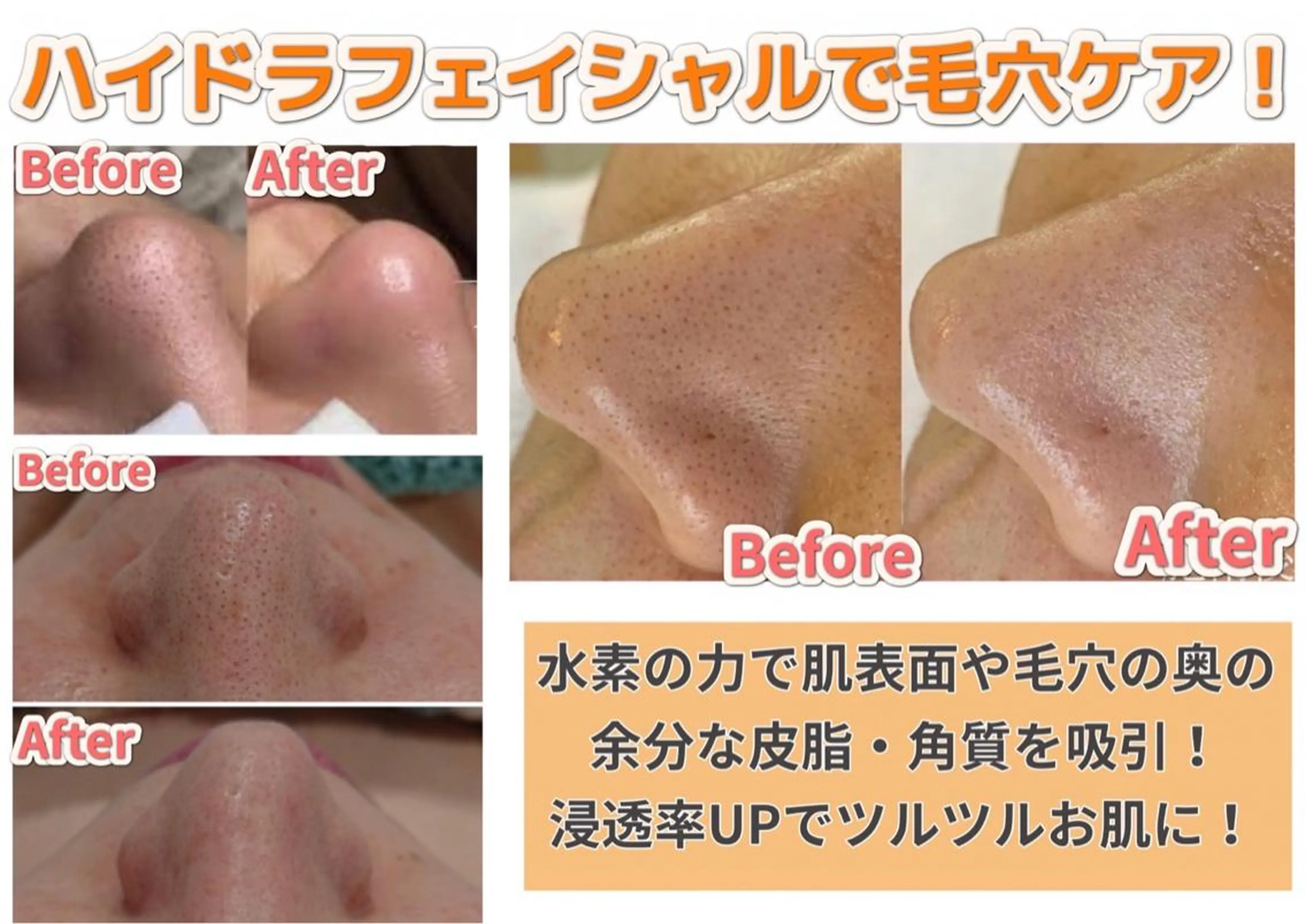 nail salon mieux(ミュー)のマツエク・マツパデザイン