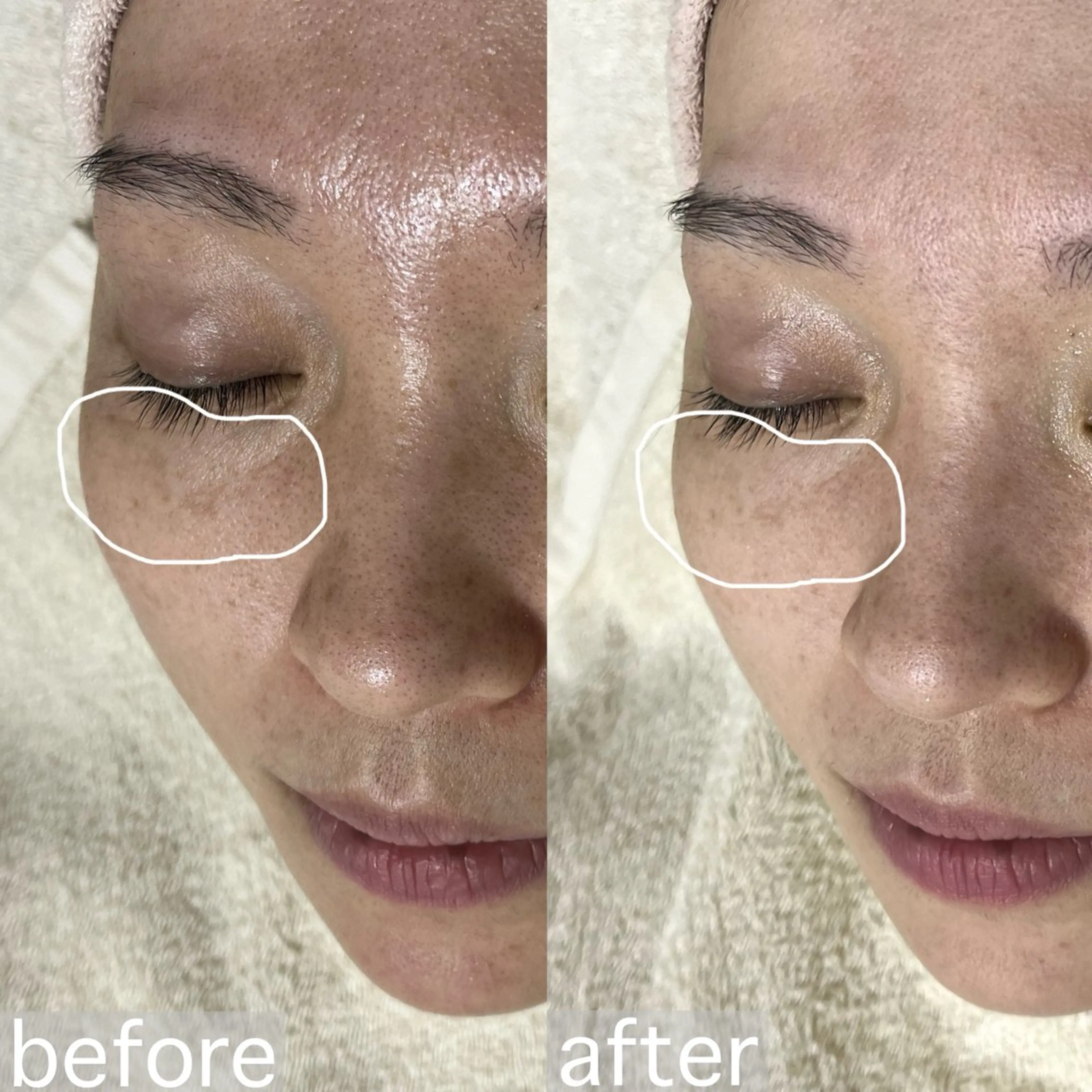 アイブロウ&フェイシャルサロンa‘lm所属・WAX脱毛/肌質改善 眉毛とお肌のサロンのエステ・リラクイメージ