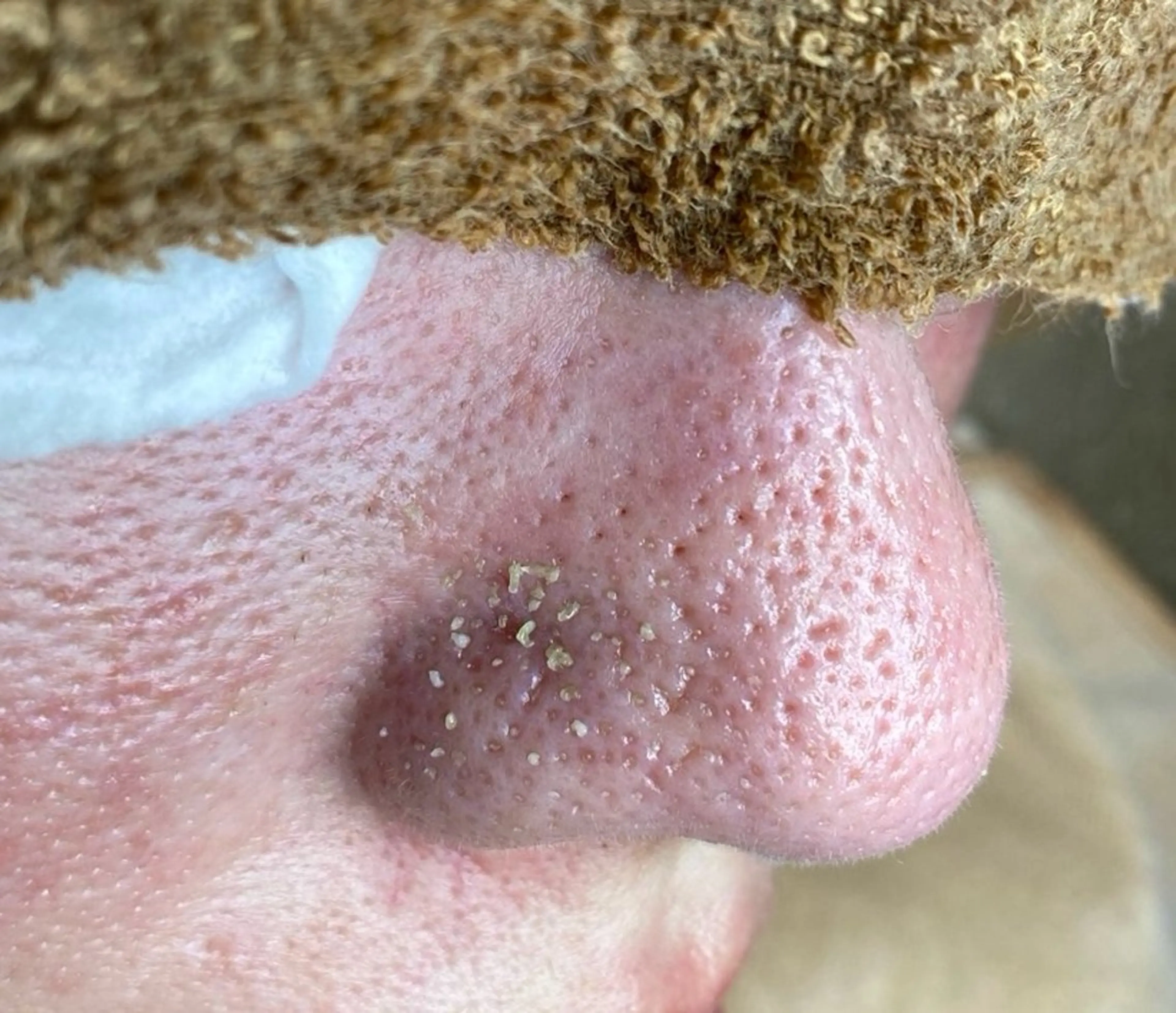 毛穴専門店【各務原】 天使の毛穴のエステ・リラクイメージ