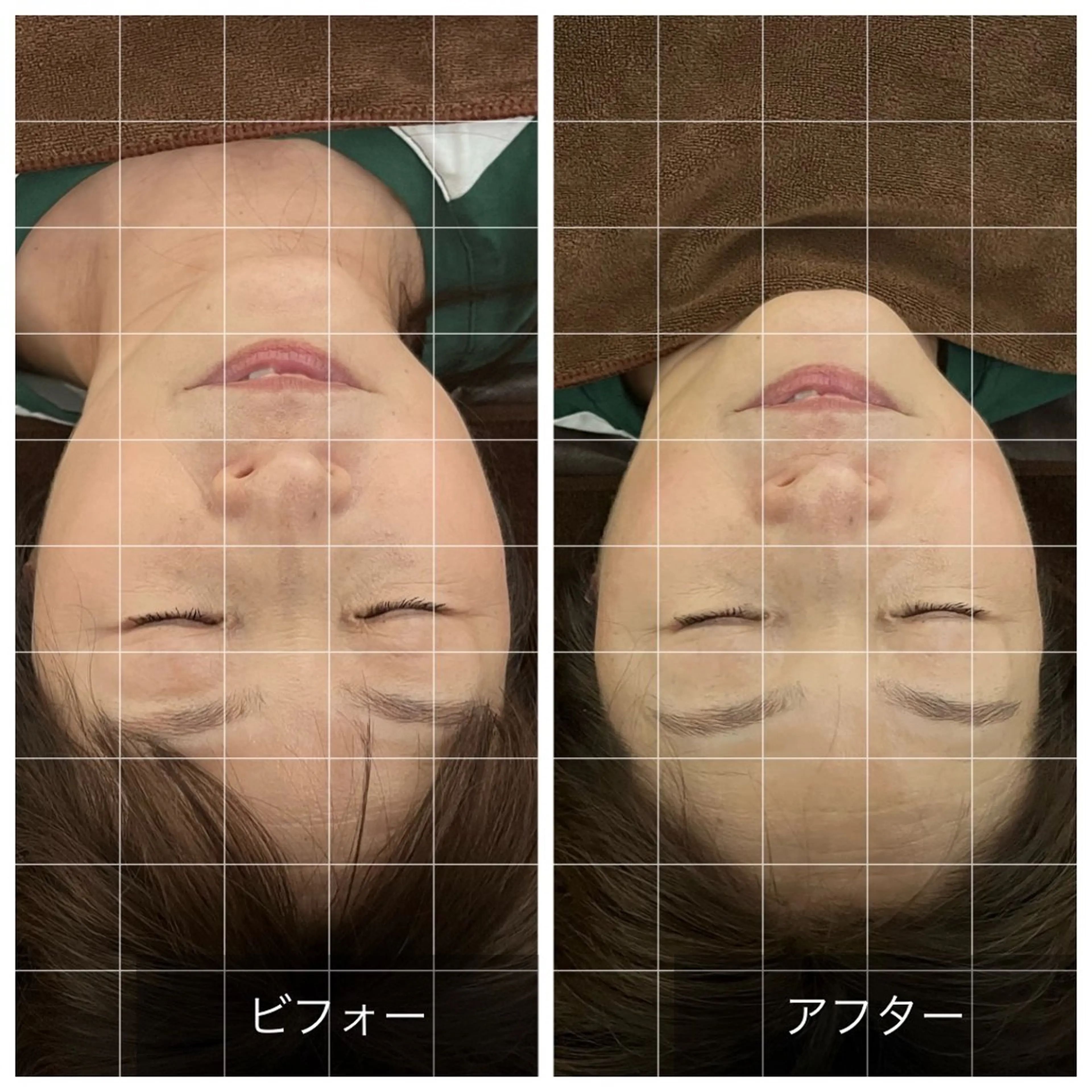 【平日割】脳洗浄ドライコースの写真