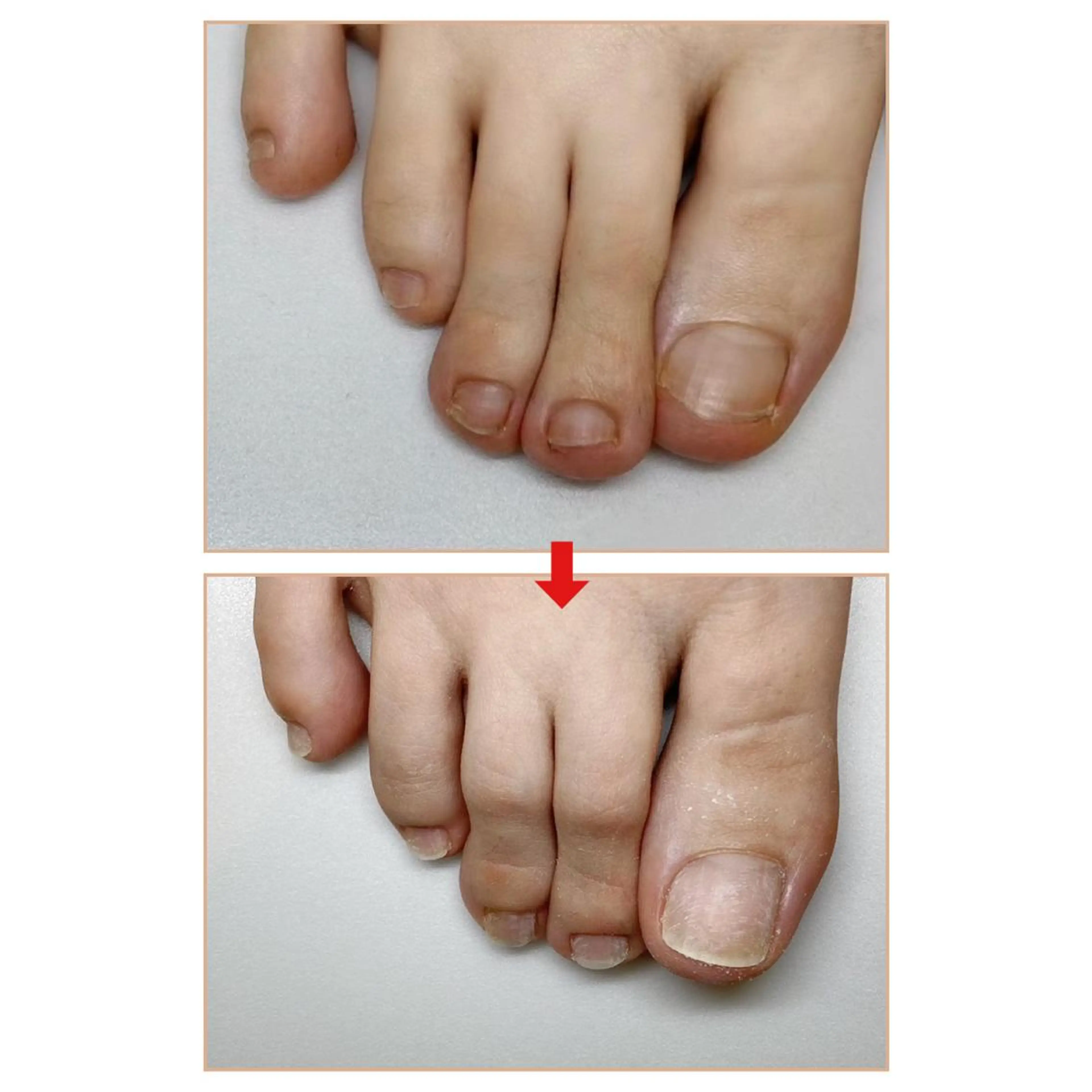 ネイル ネイルサロン アリュームのネイルデザイン