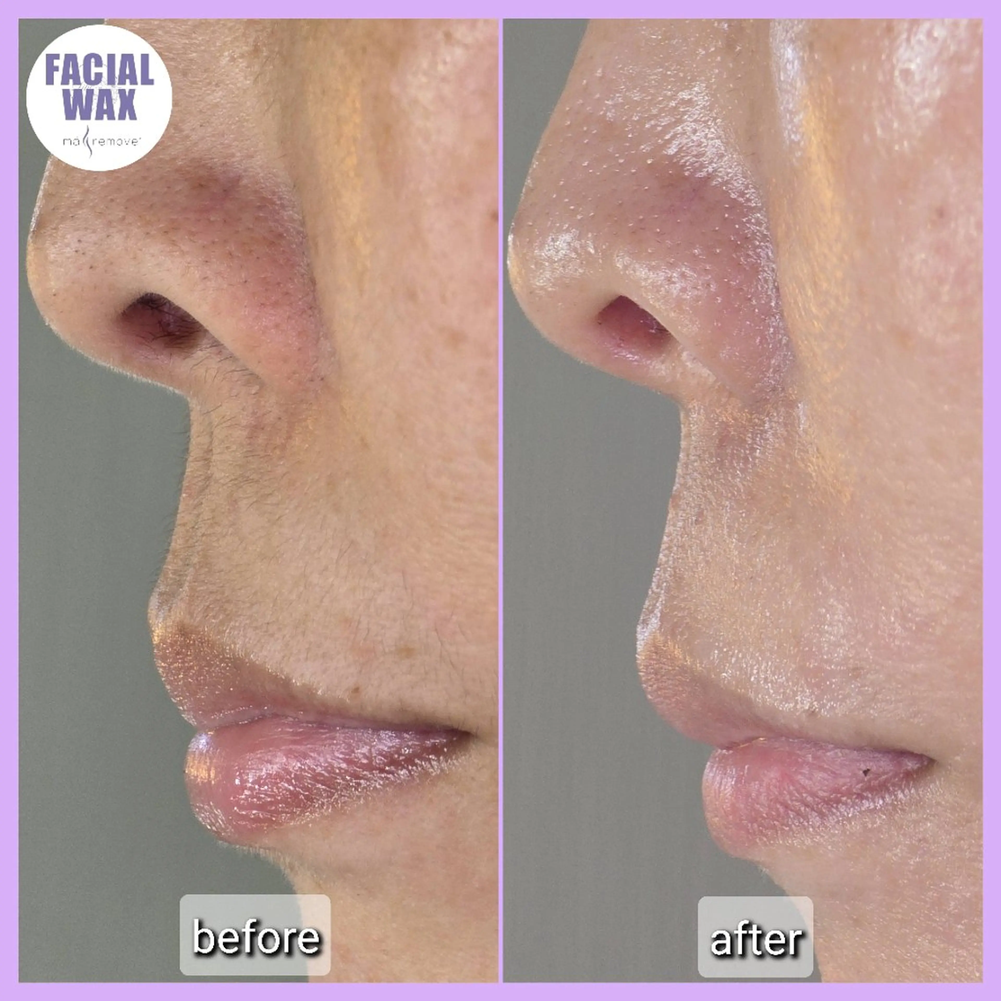 脱毛 salon Lilyのエステ・リラクイメージ