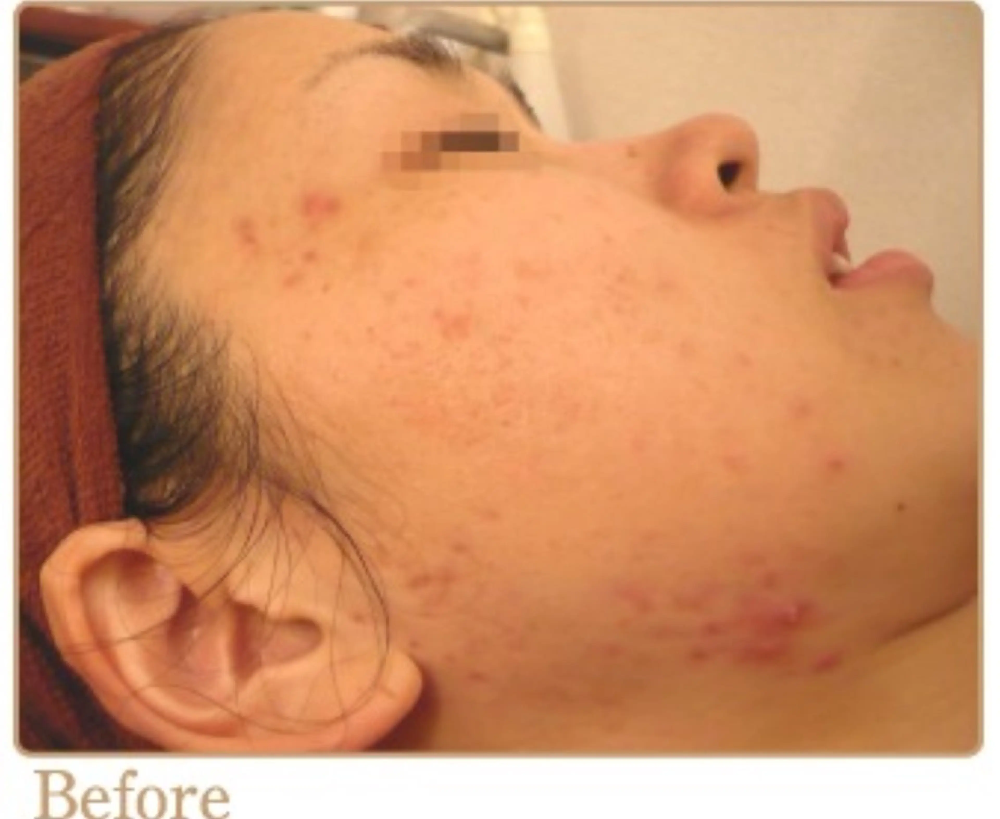 ピーリングサロン シャンテールのエステ・リラクイメージ