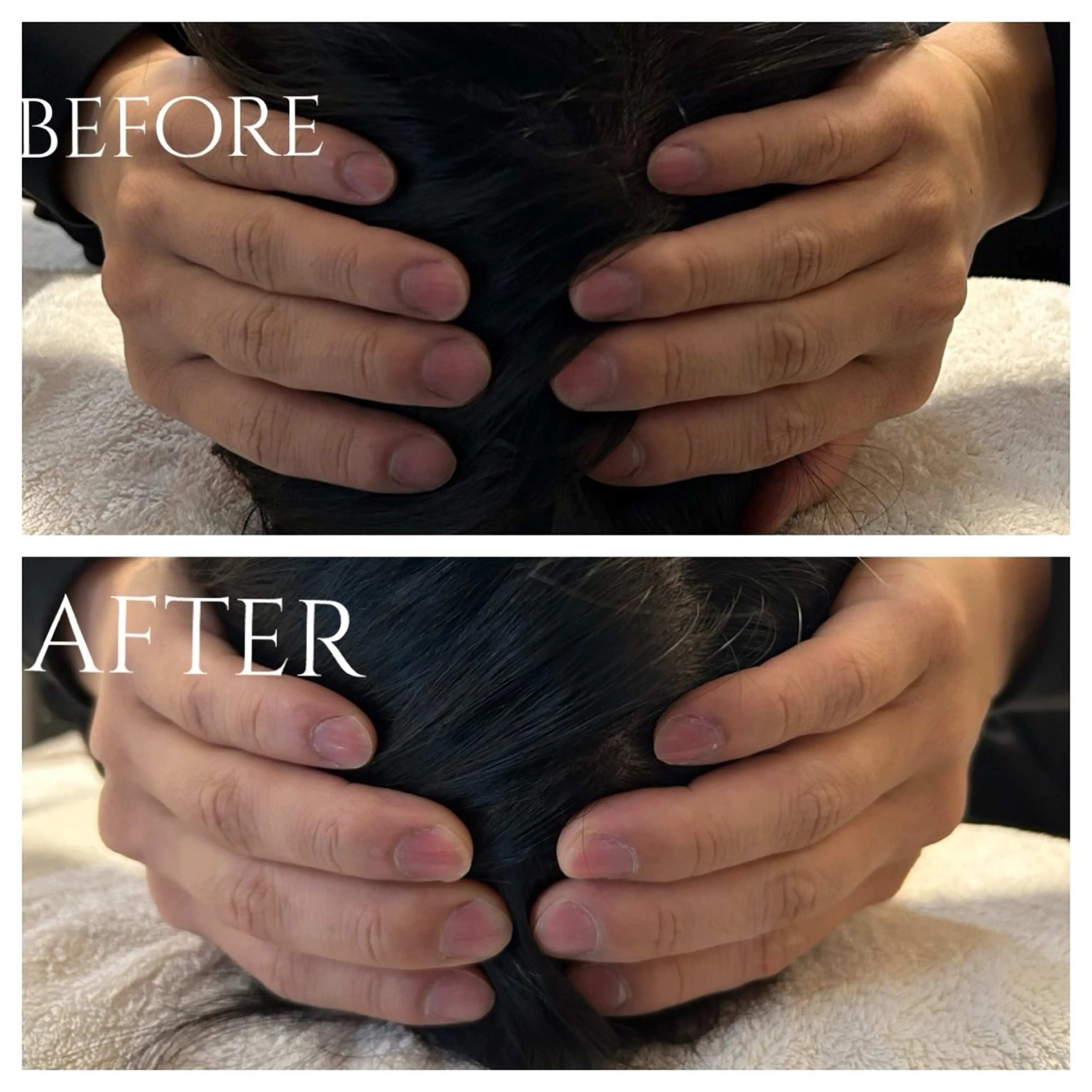 【速攻実感⁉️】小顔矯正ヘッドスパの写真