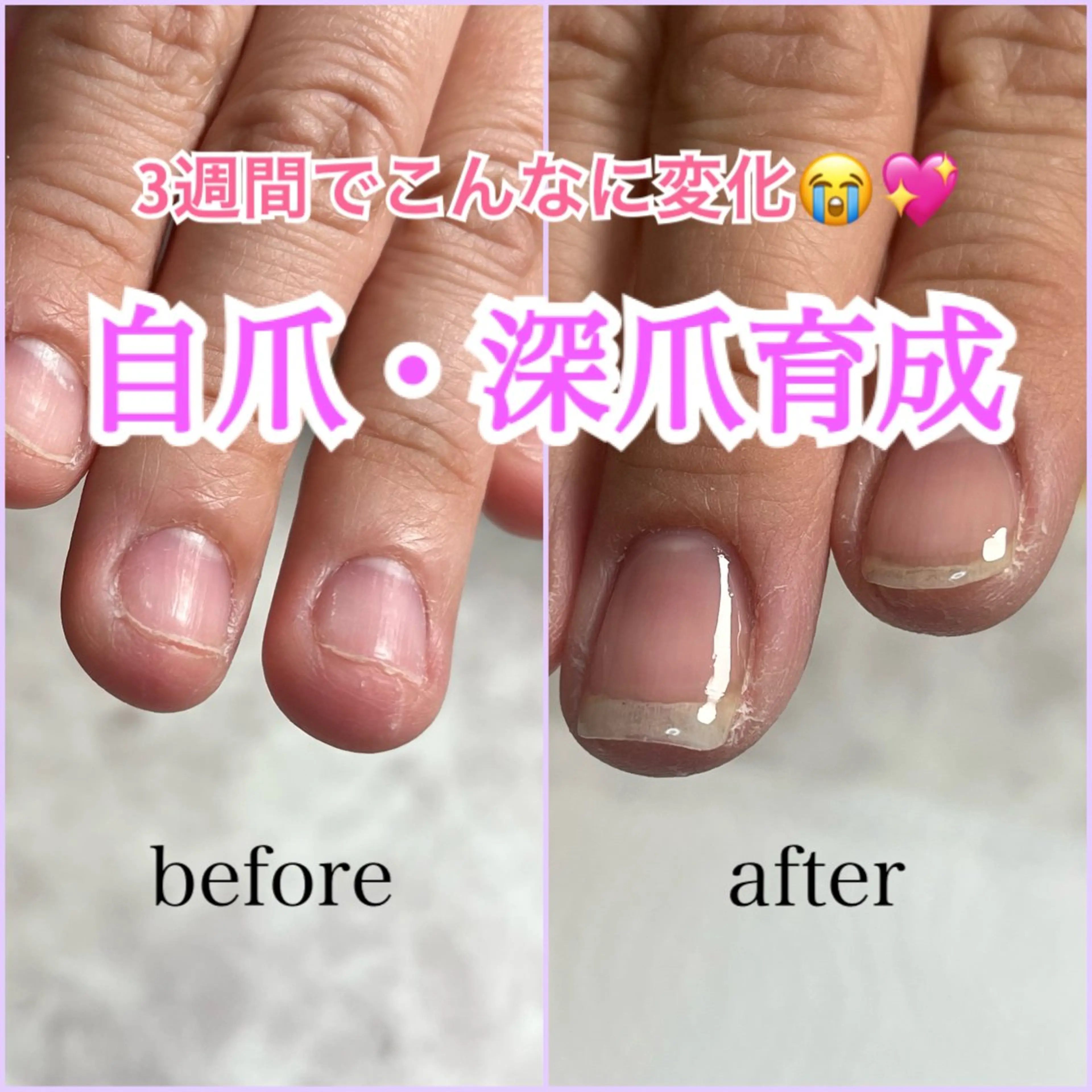 ネイル ❁miju nail 大人上品/自爪育成のネイルデザイン