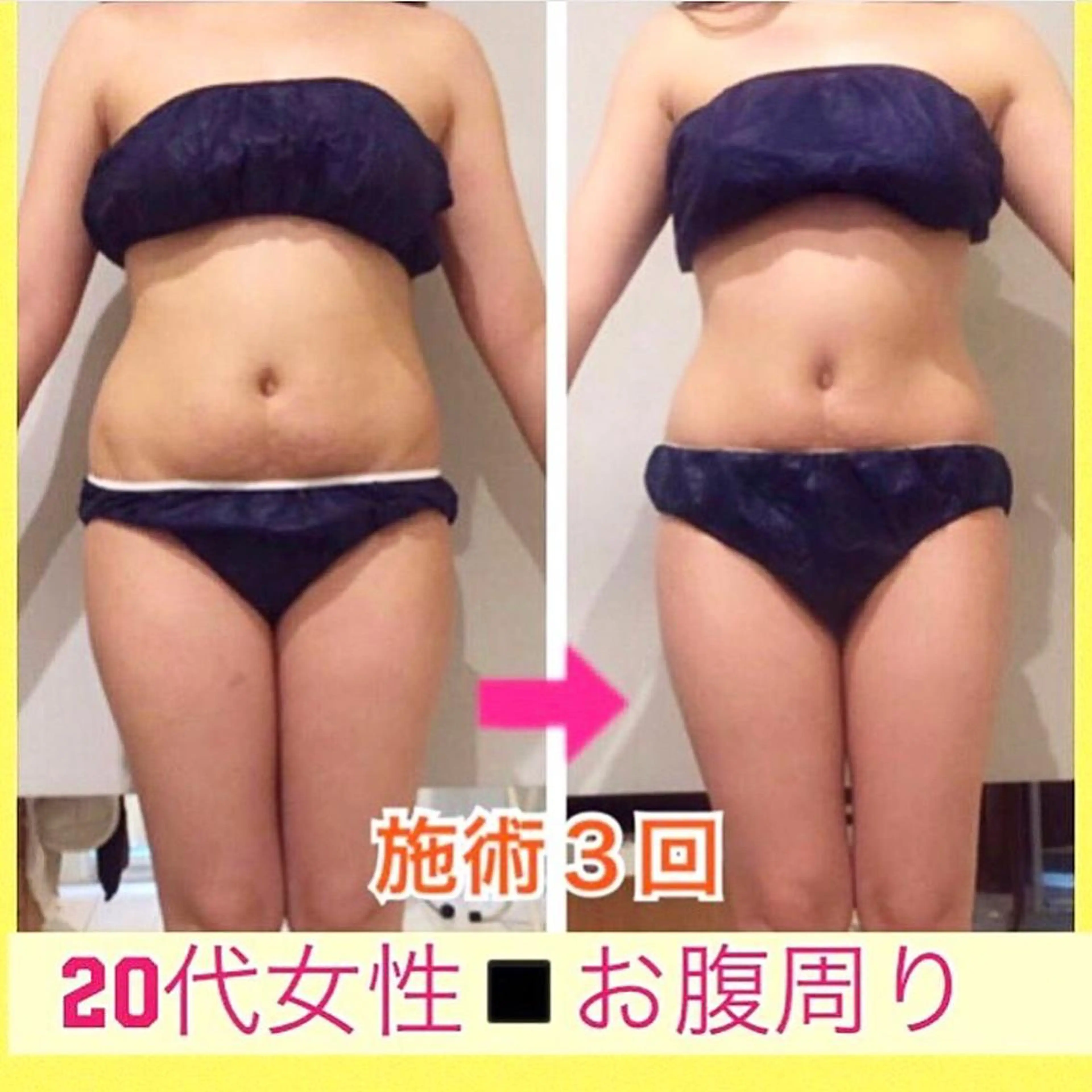 ショート カラー パーマ ヘアアレンジ メンズ キッズ ネイル マツエク・マツパ ‍痩身＆ボディ 結果出し🌟丹野のエステ・リラクイメージ