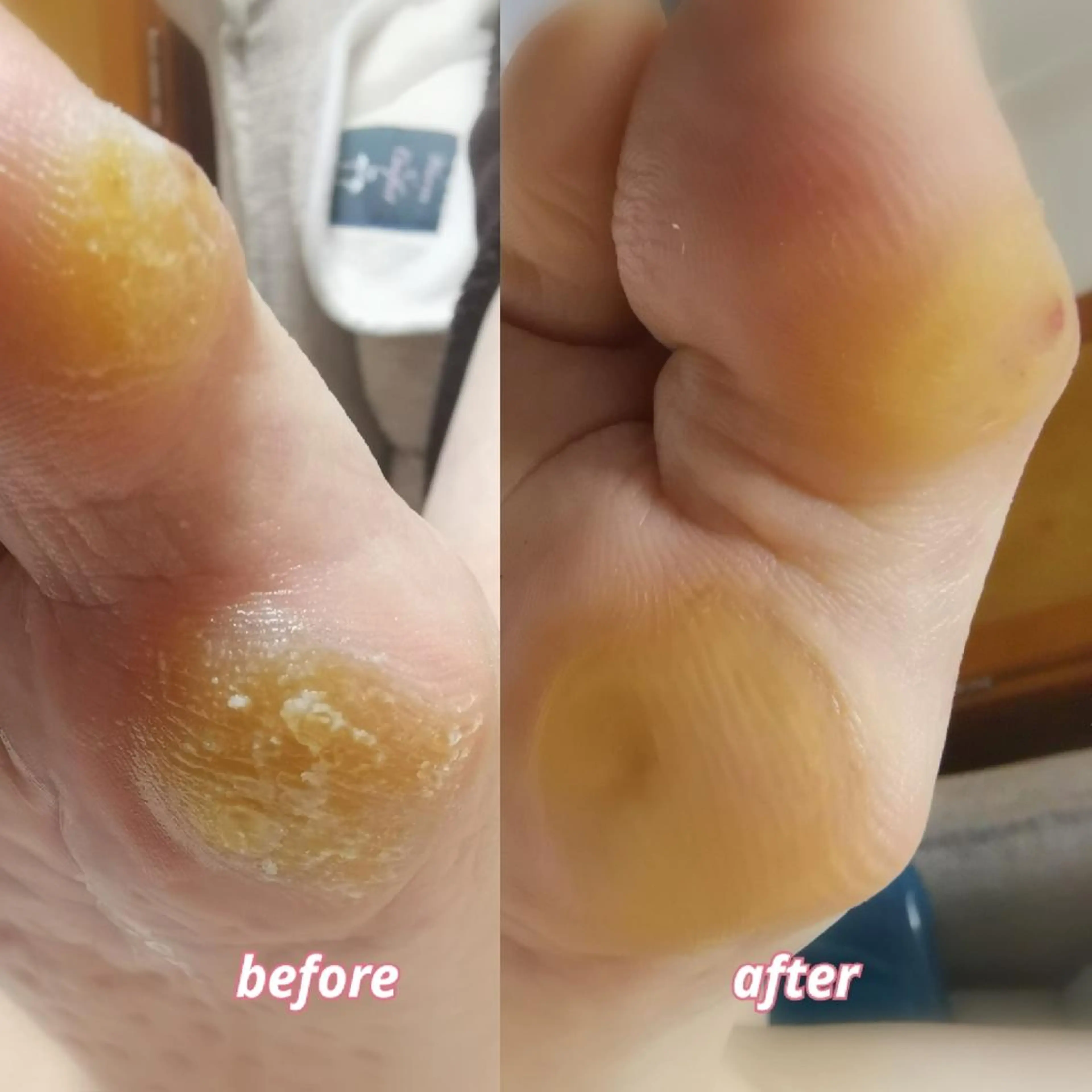 ネイル フットネイル reve あやののネイルデザイン