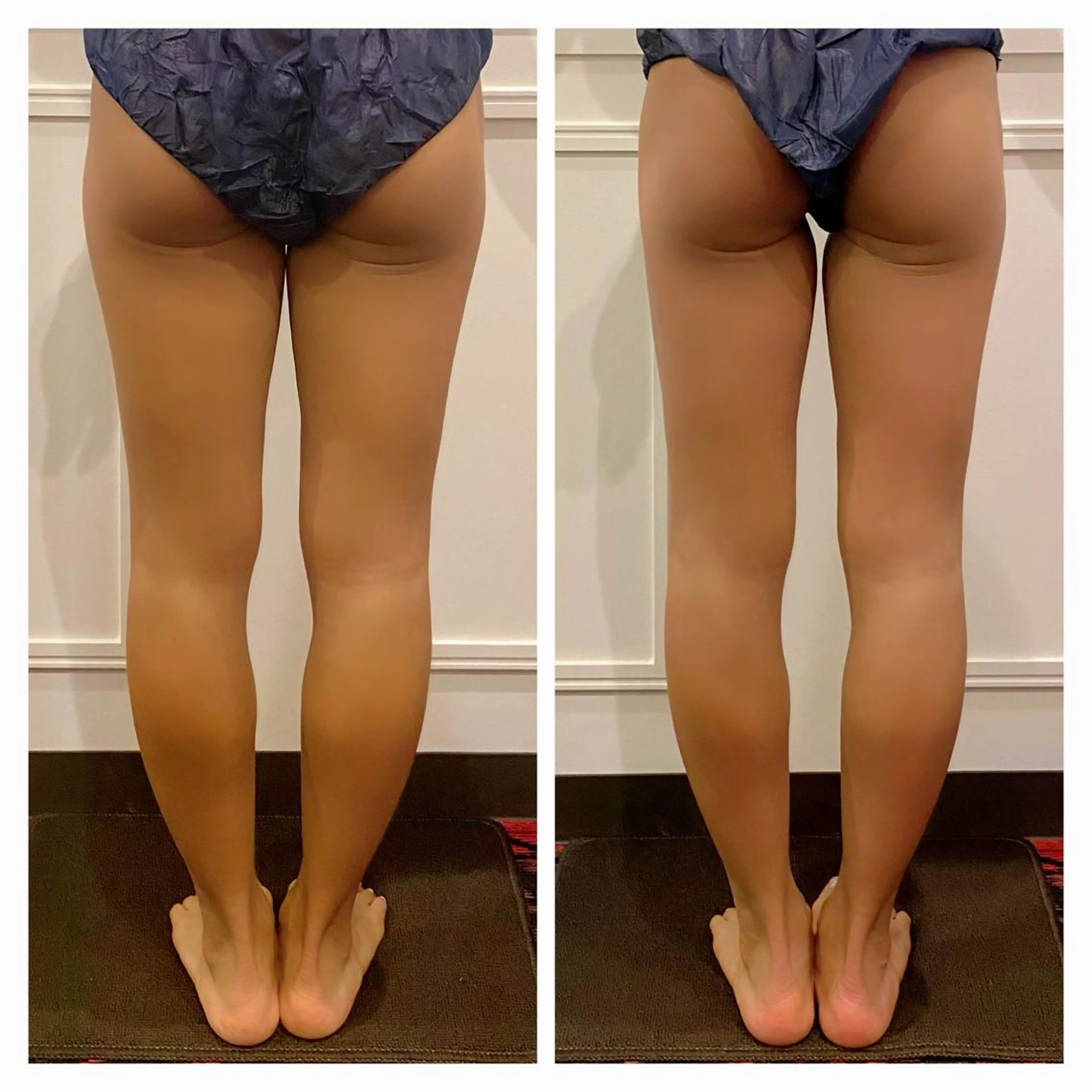 【フルボディ美ライン💫ポイント集中コース】(二の腕/背中/ウエスト/お腹/太もも/ふくらはぎ)90分 ¥9,800の写真