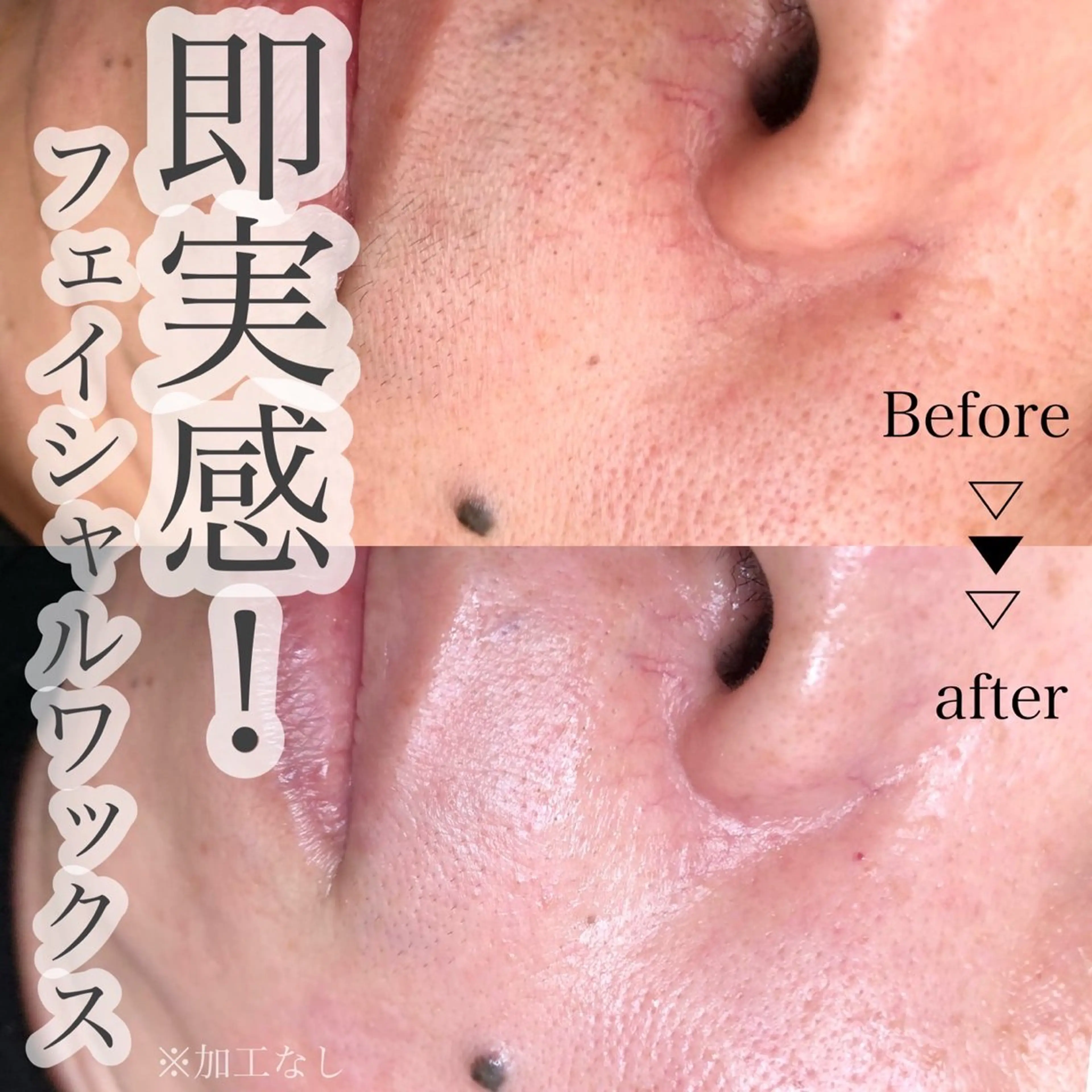 脱毛 eim Ayakaのネイルデザイン