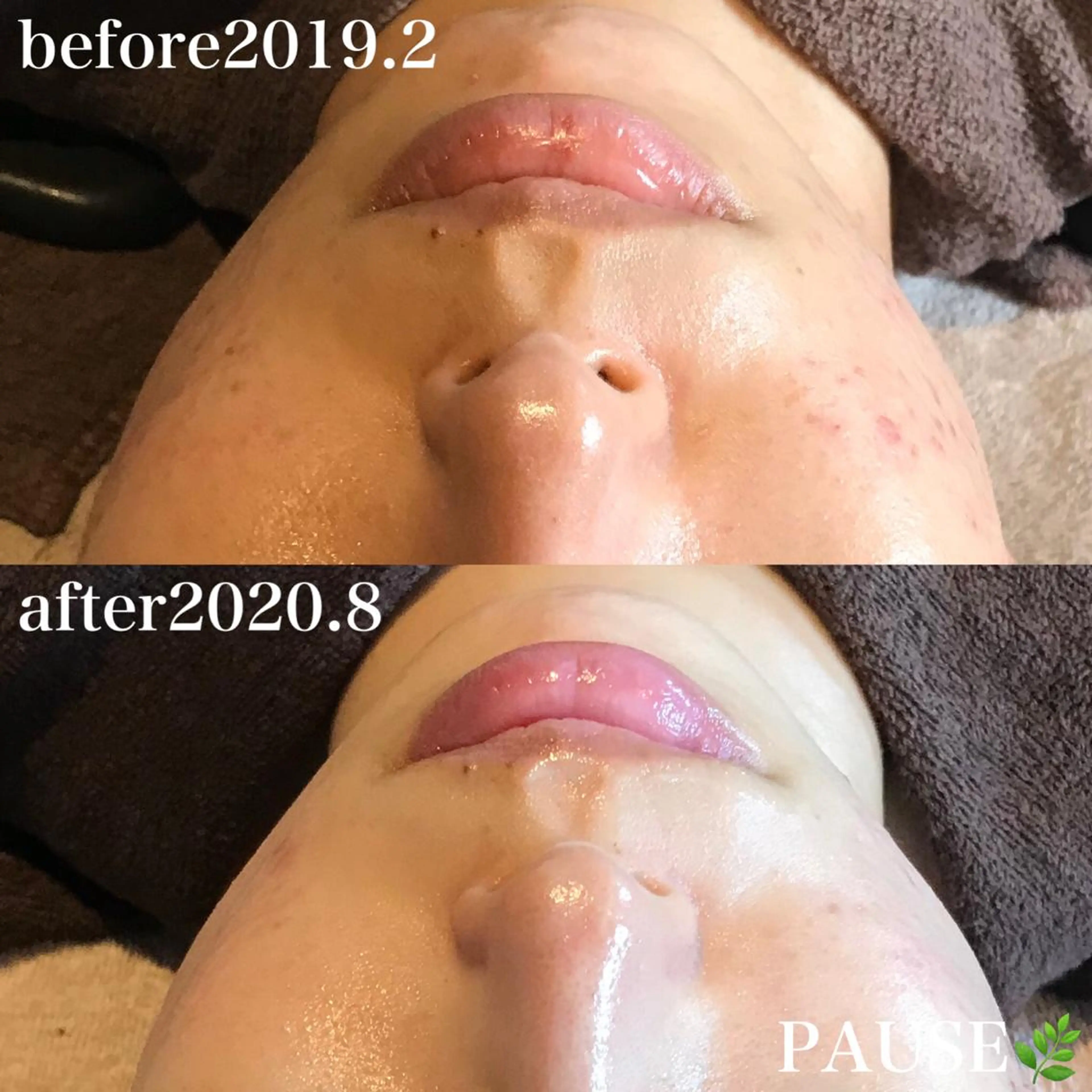 エステ 浜野 恵美のエステ・リラクイメージ