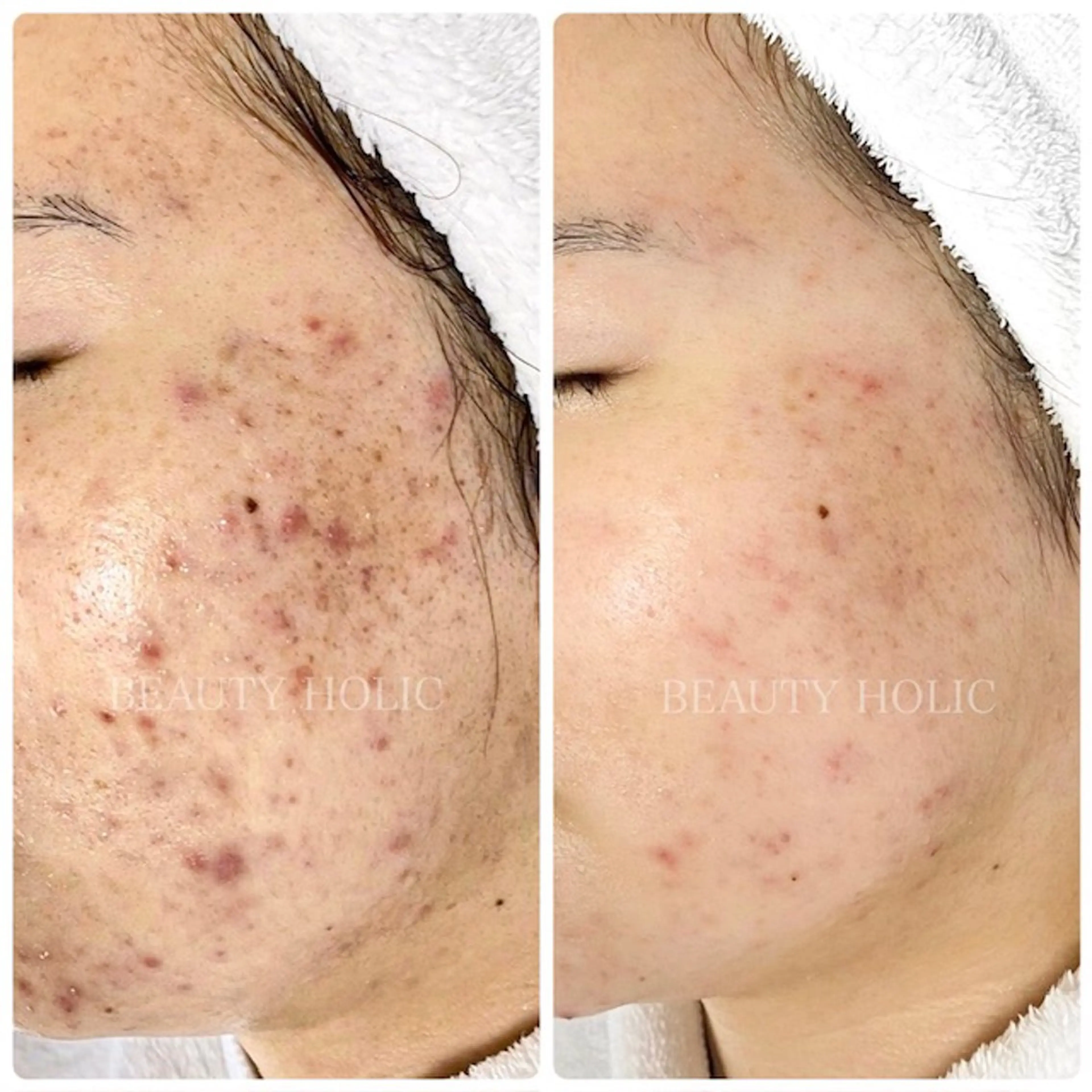 ビューティーホリック 東金店のエステ・リラクイメージ