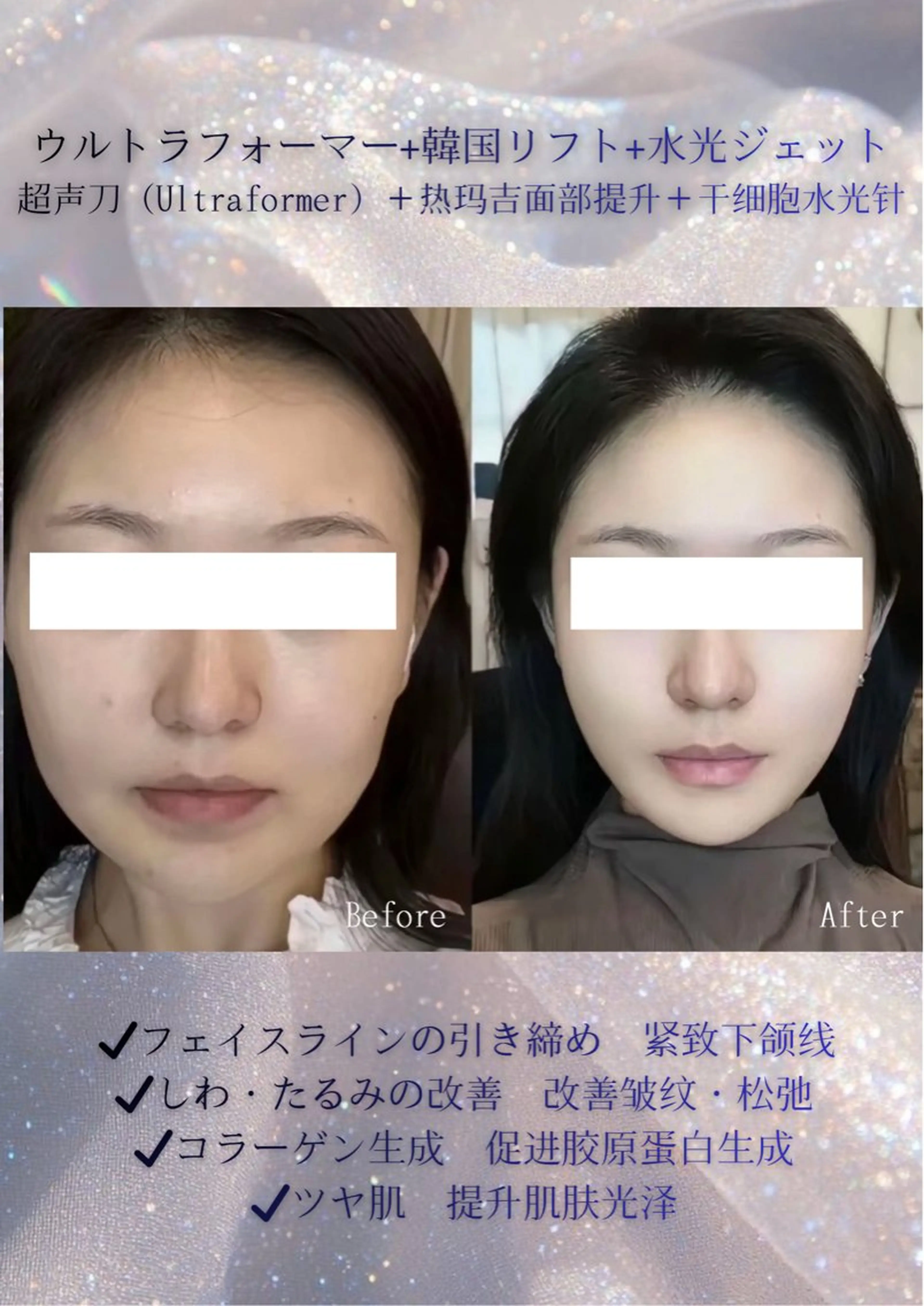 マツエク・マツパ エステ リラク 愛維美水光美肌専門店 メンズレディースokのエステ・リラクイメージ