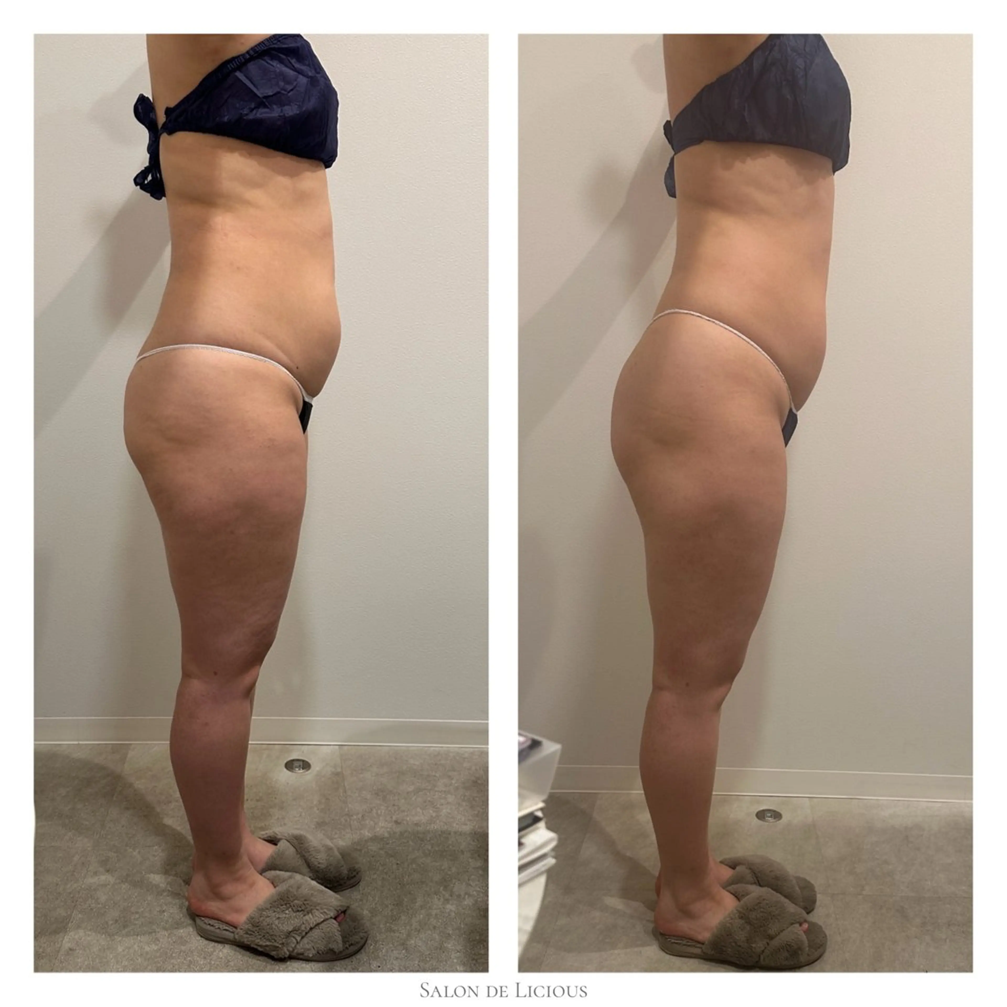 エステ 桜新町 Sakurakoの眉毛・アイブロウイメージ