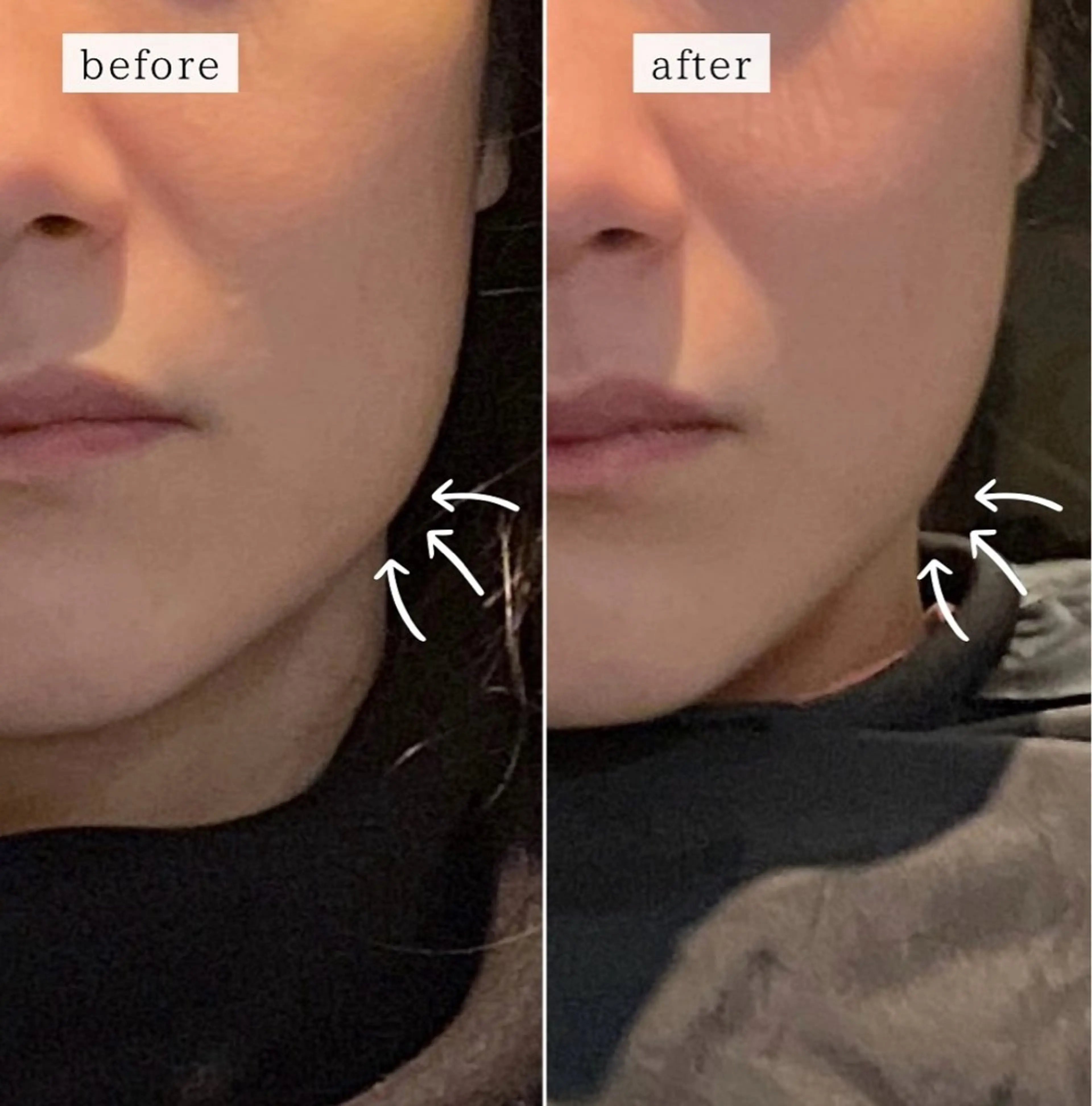 小顔矯正/ヘッドスパ /Arieのエステ・リラクイメージ