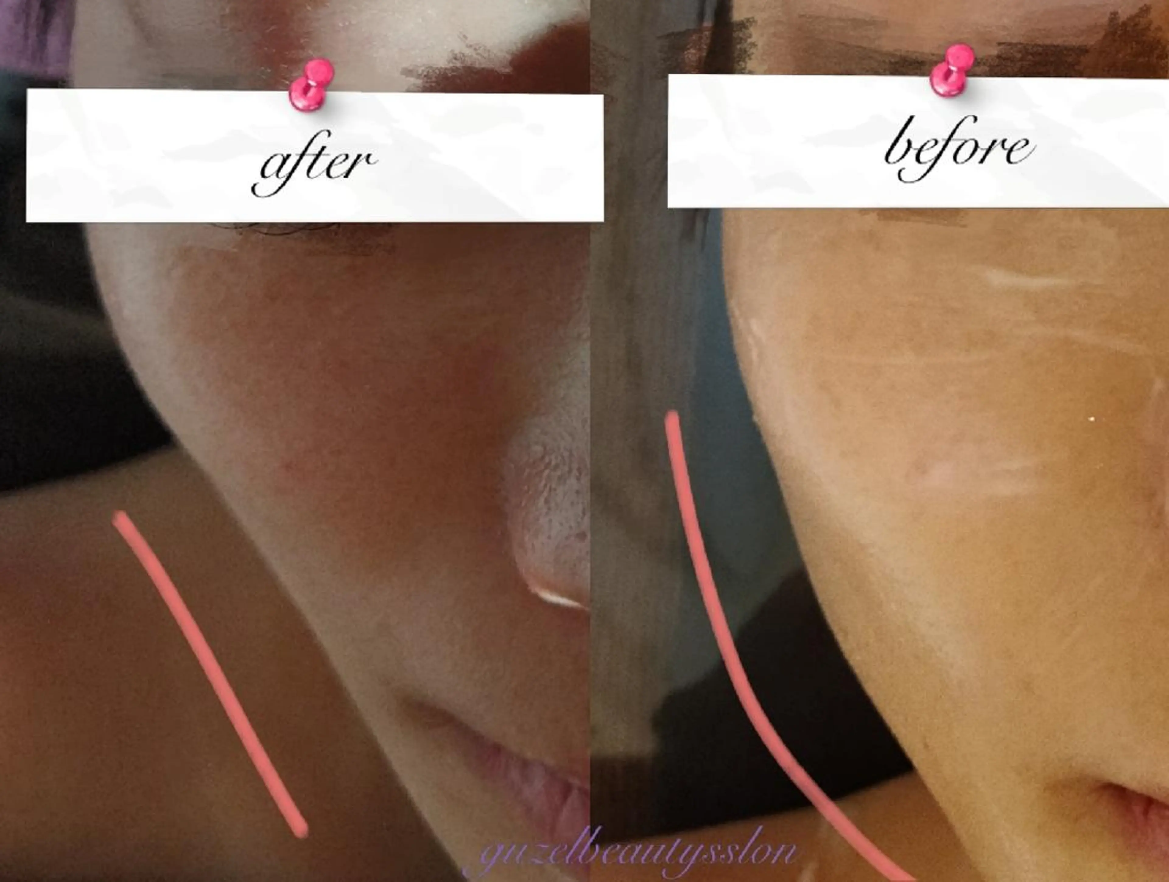 🅖🅤🅩🅔🅛 salonのエステ・リラクイメージ