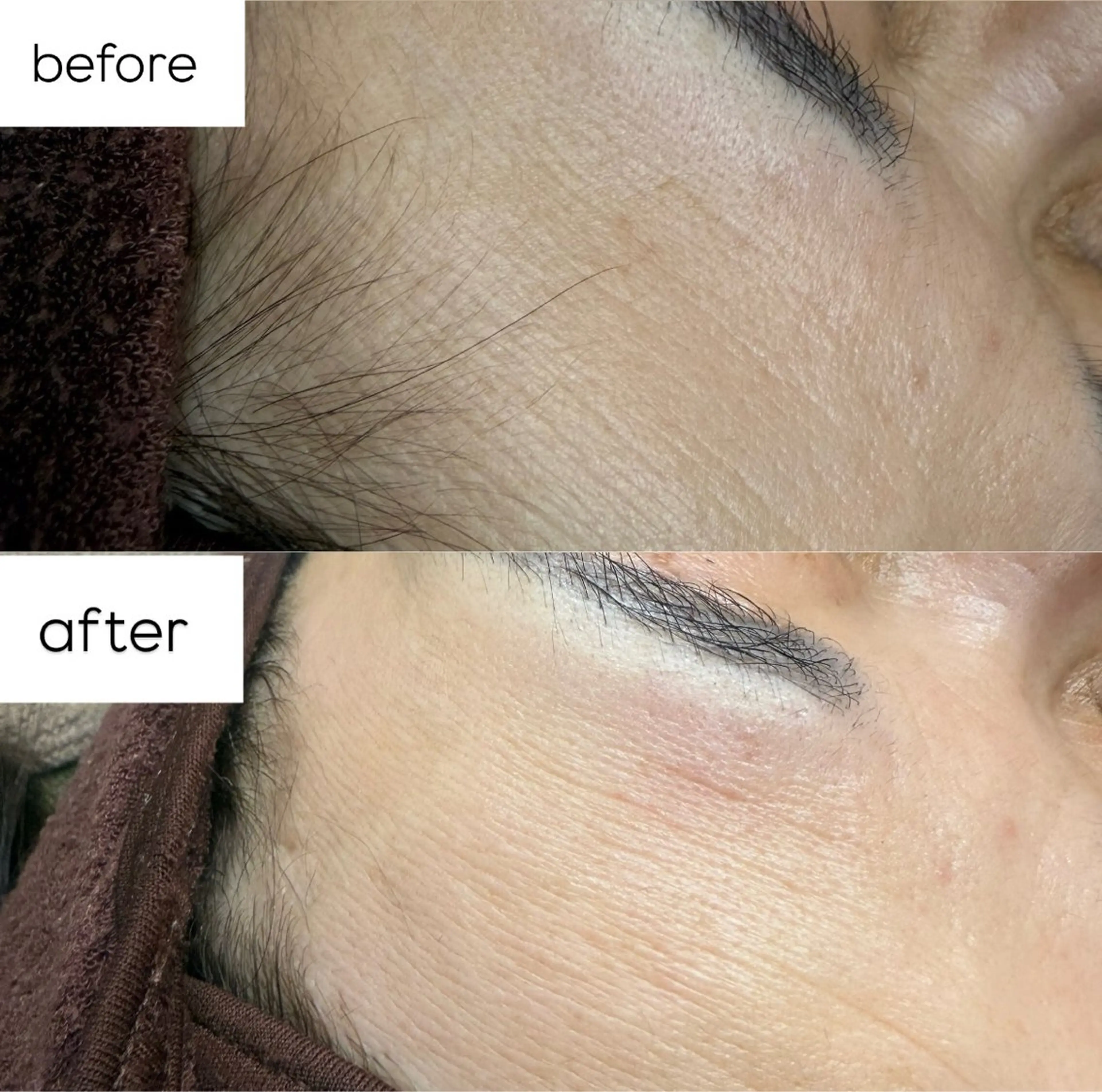脱毛 駒月 明日香の眉毛・アイブロウイメージ
