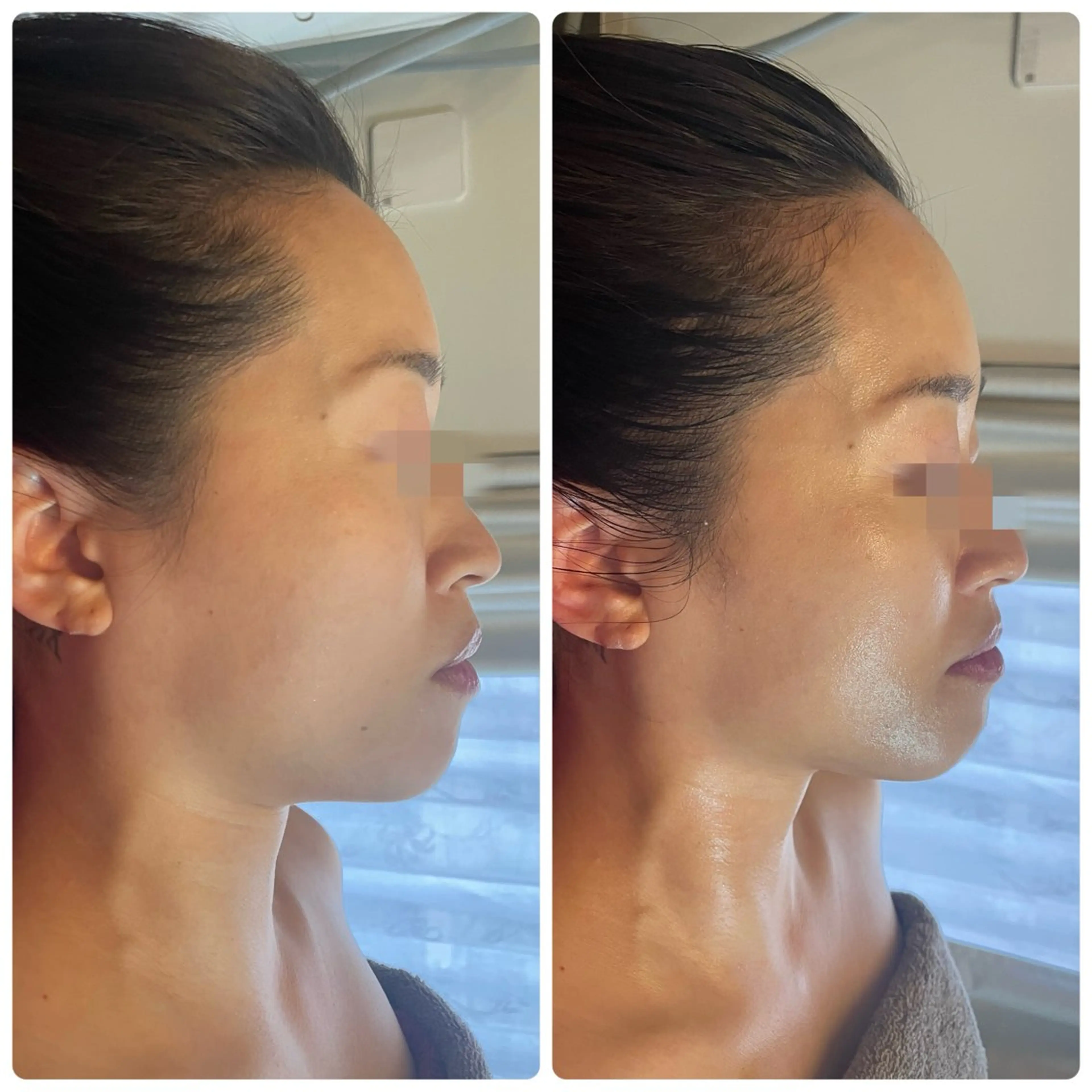 【代謝×免疫UP】お肌と身体のオールハンド専門店estheya sign所属・深層筋×筋膜リリース 首肩こり/むくみのエステ・リラクイメージ