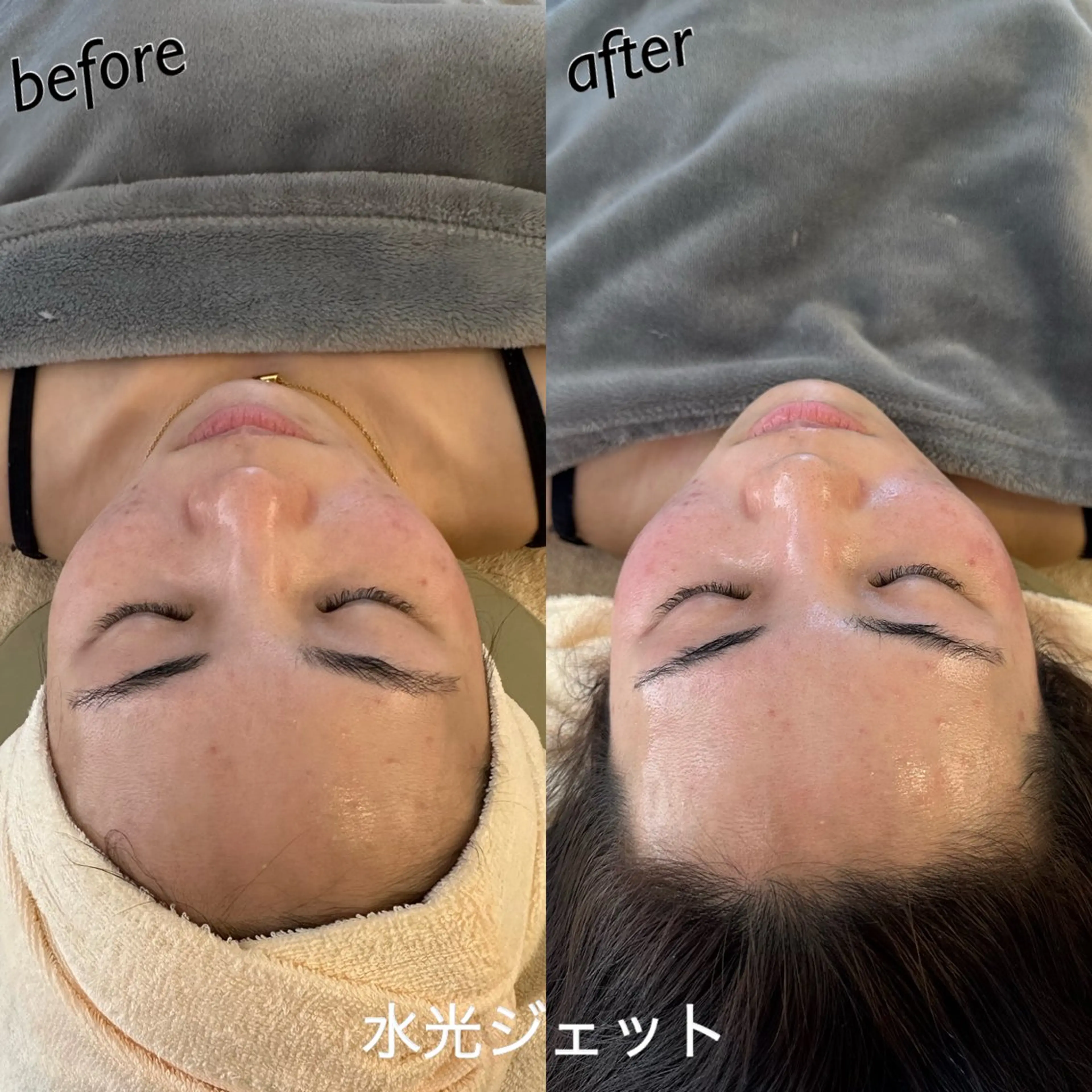 エステ うなじ脱毛/美肌脱毛 LABELのエステ・リラクイメージ