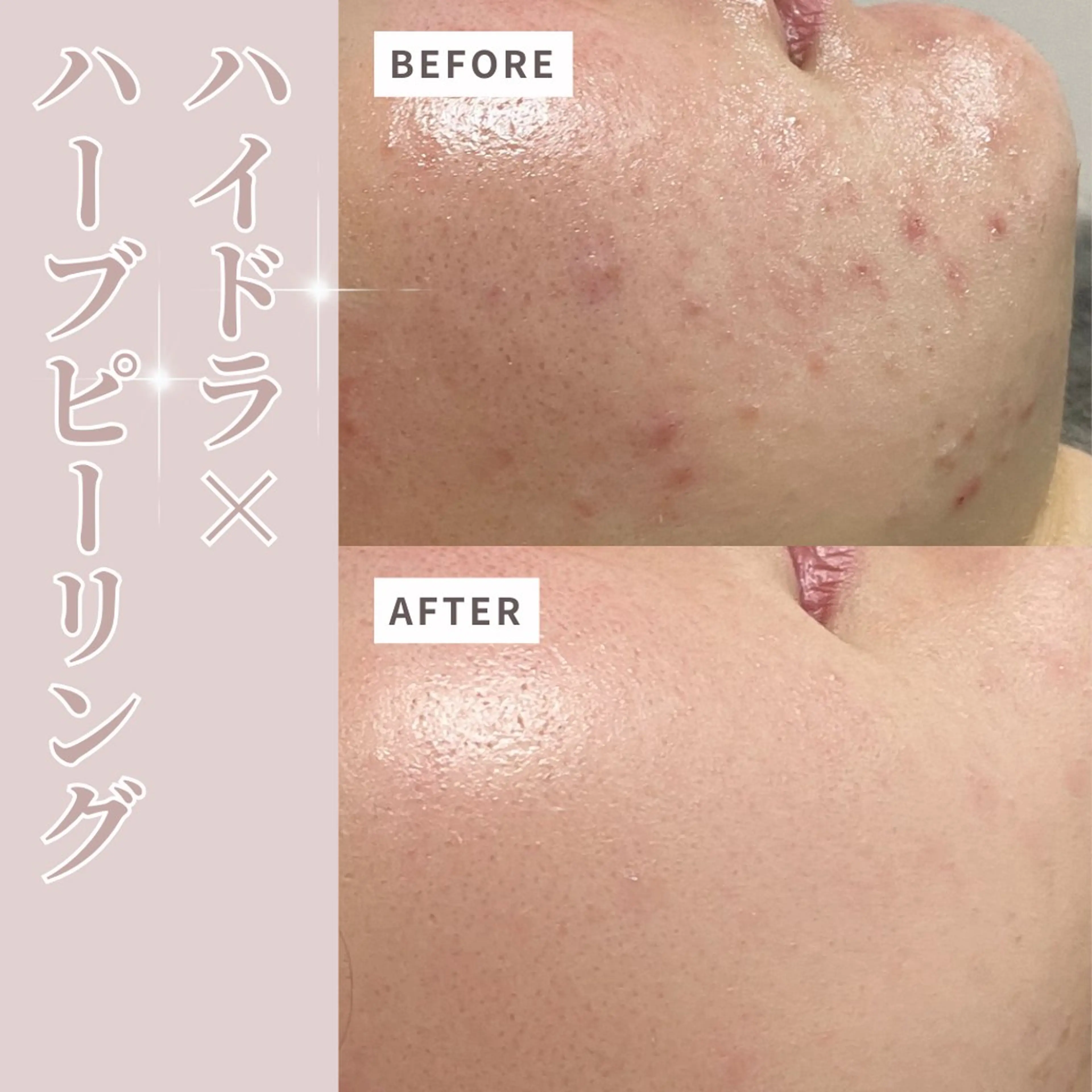 その他 プライベートサロン Belle（ベル）のエステ・リラクイメージ