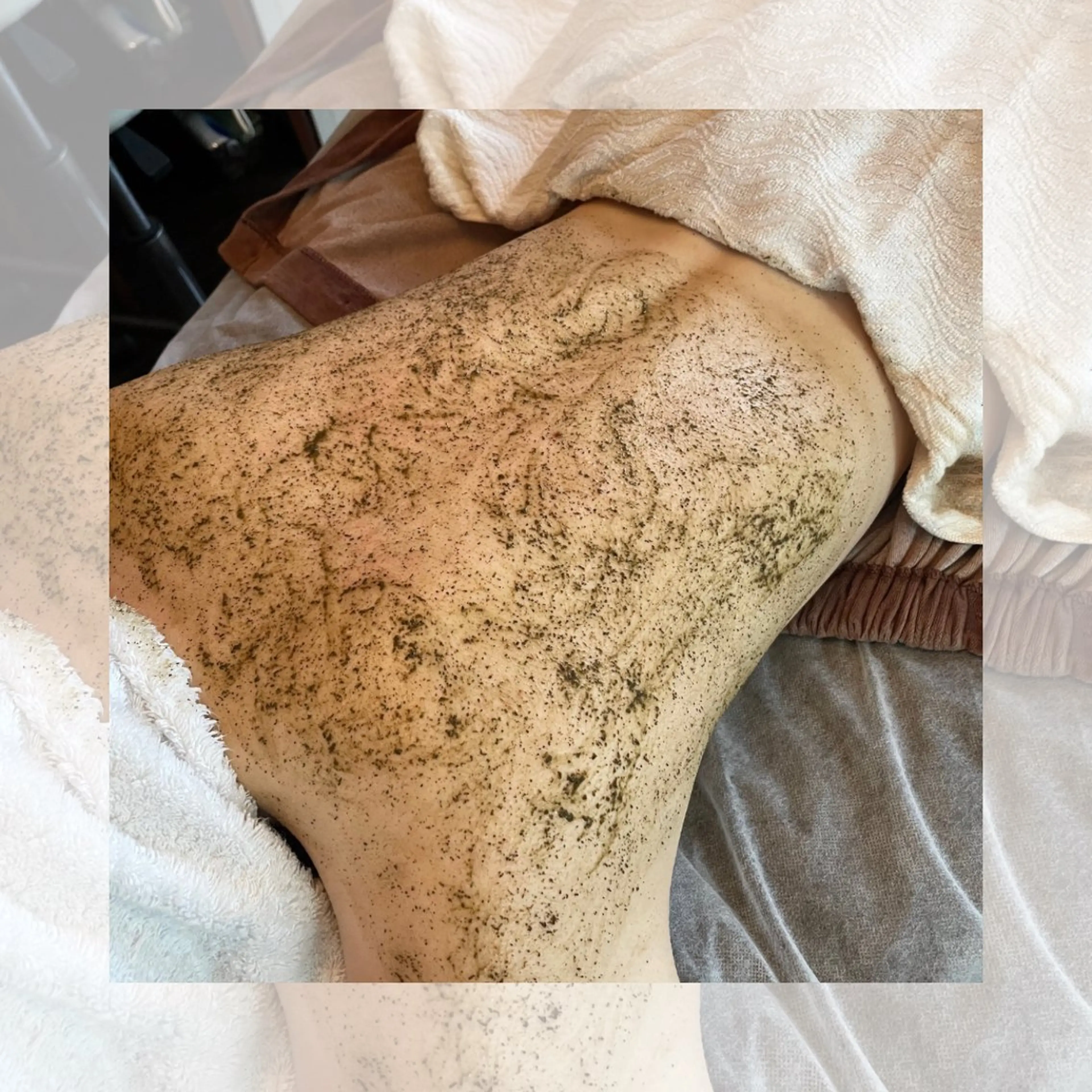 【◉お試し背中上REVIハーブピーリング】REVI陶肌トリートメントで魅せる背中¥13750→¥8250の写真