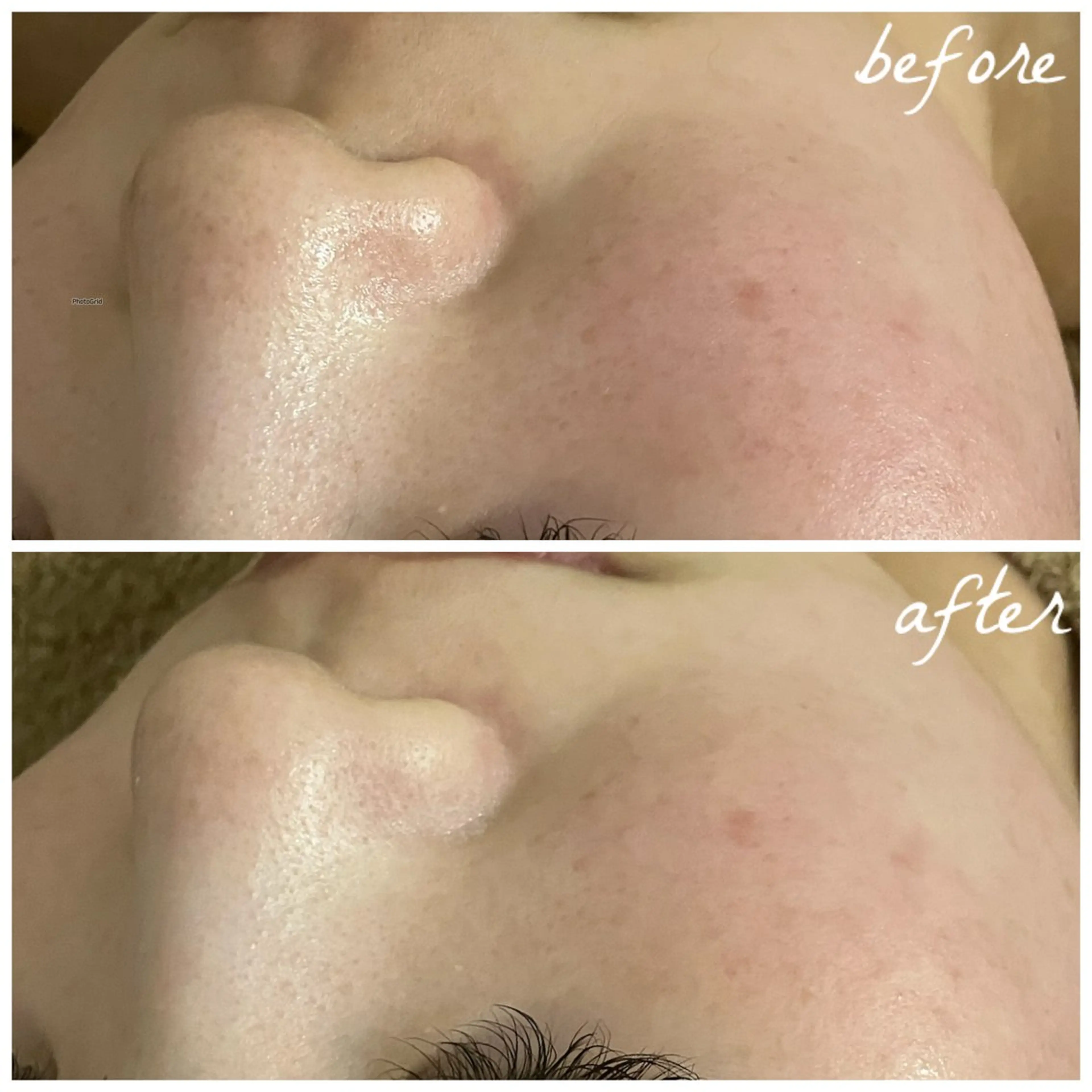 メンズ エステ メナード岐阜茜部 杉浦のエステ・リラクイメージ