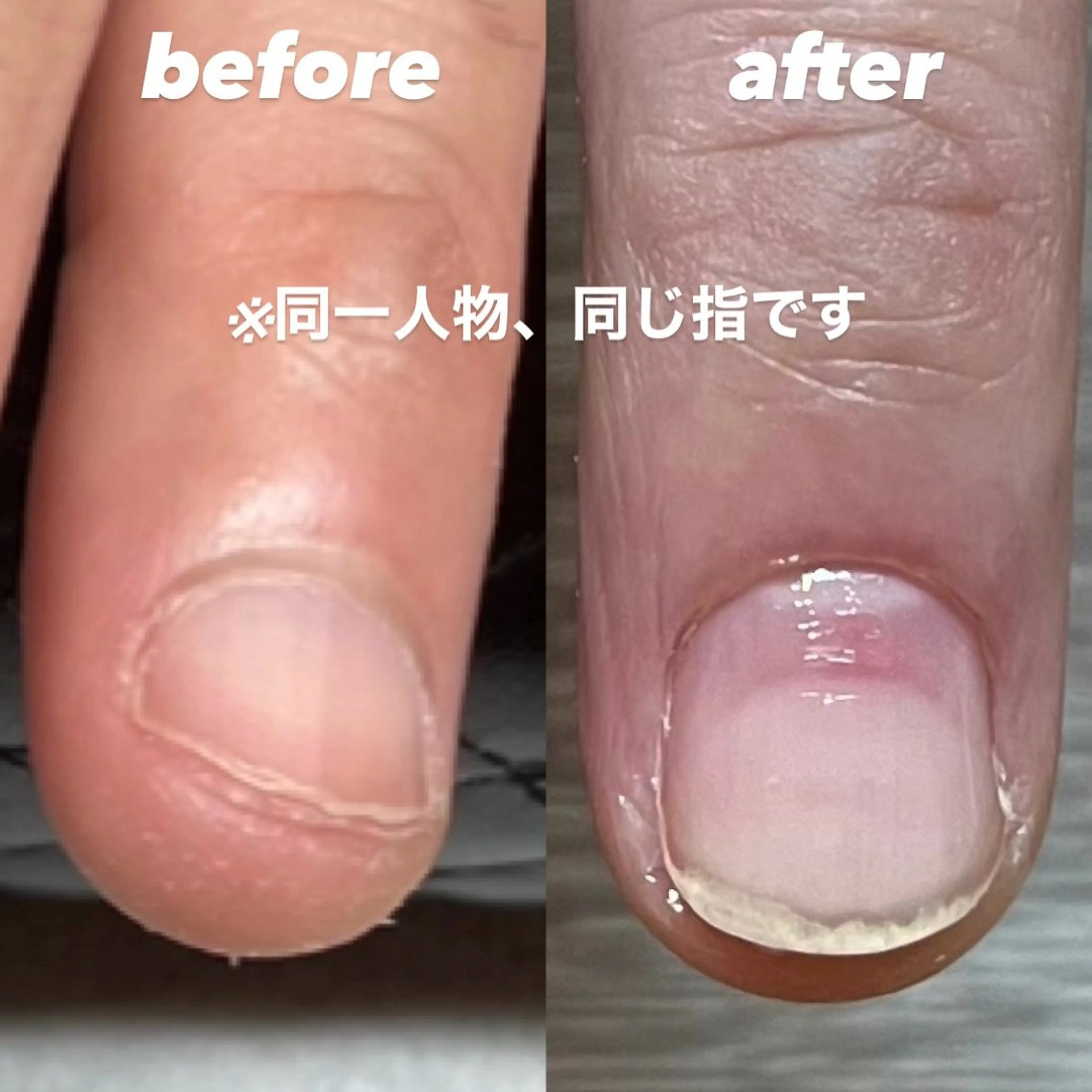 ネイル 大杉 泉翔のネイルデザイン