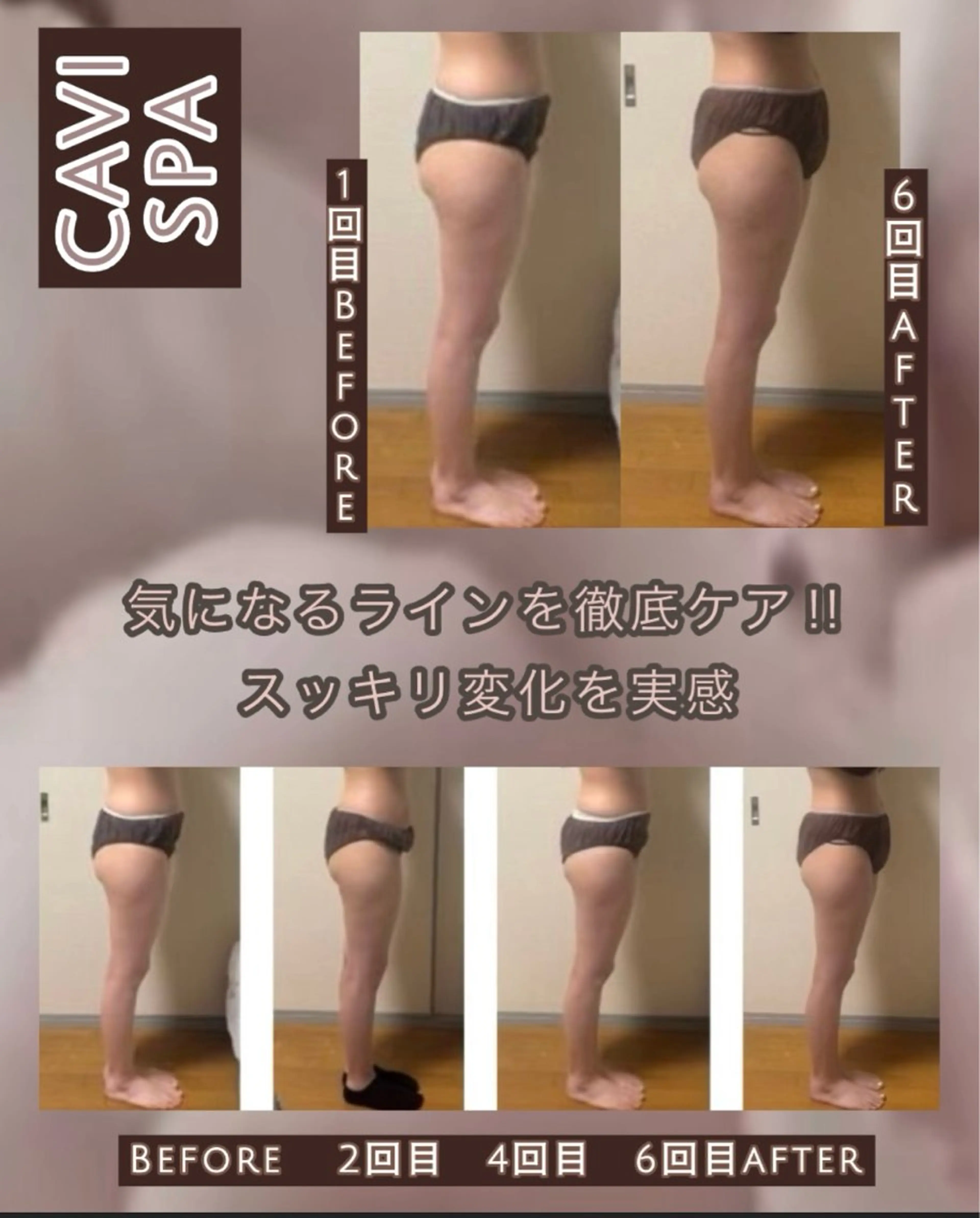 エステ ヴィーナス ビューティーのエステ・リラクイメージ