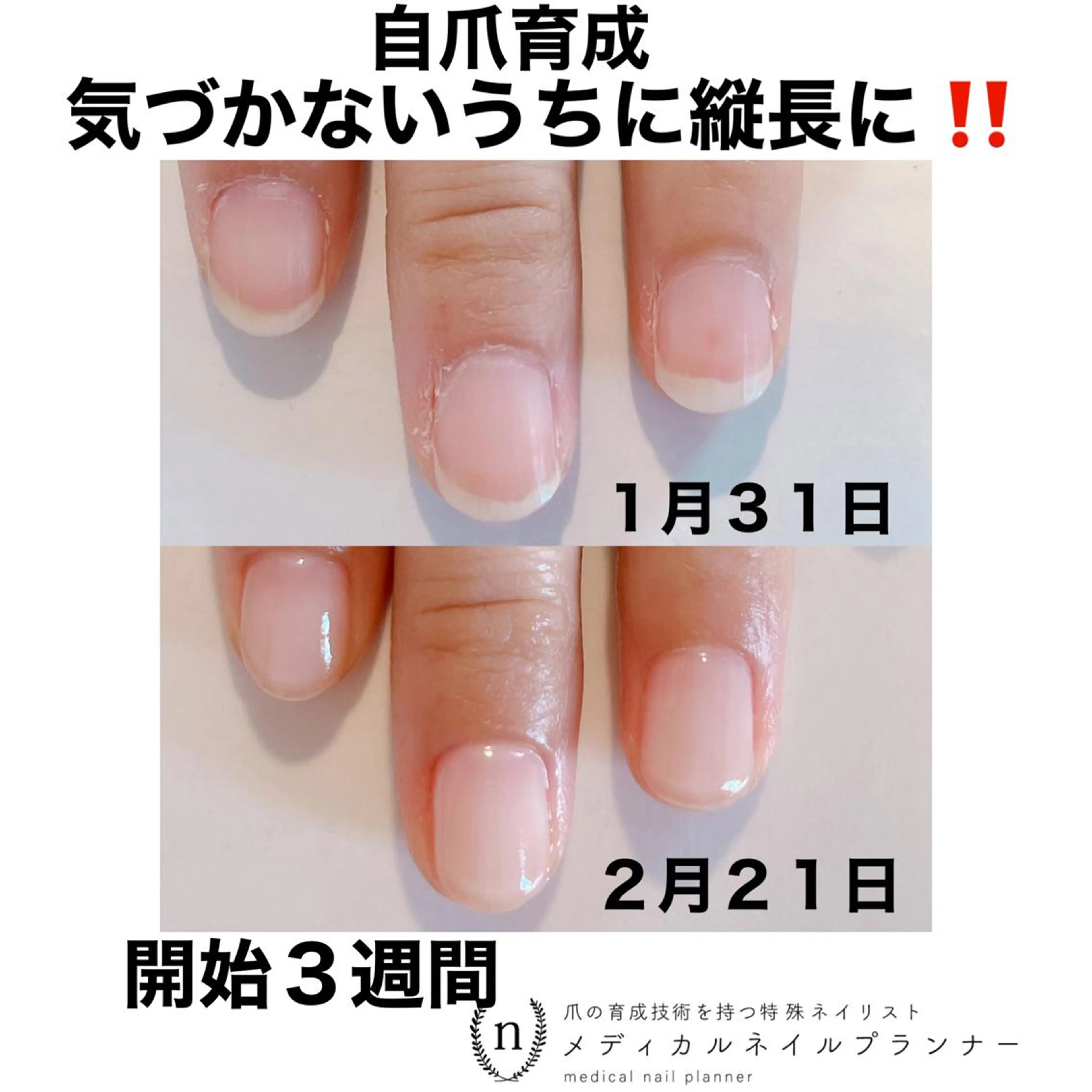 ネイル NAIL SALON ｔｏｇｇｙのネイルデザイン