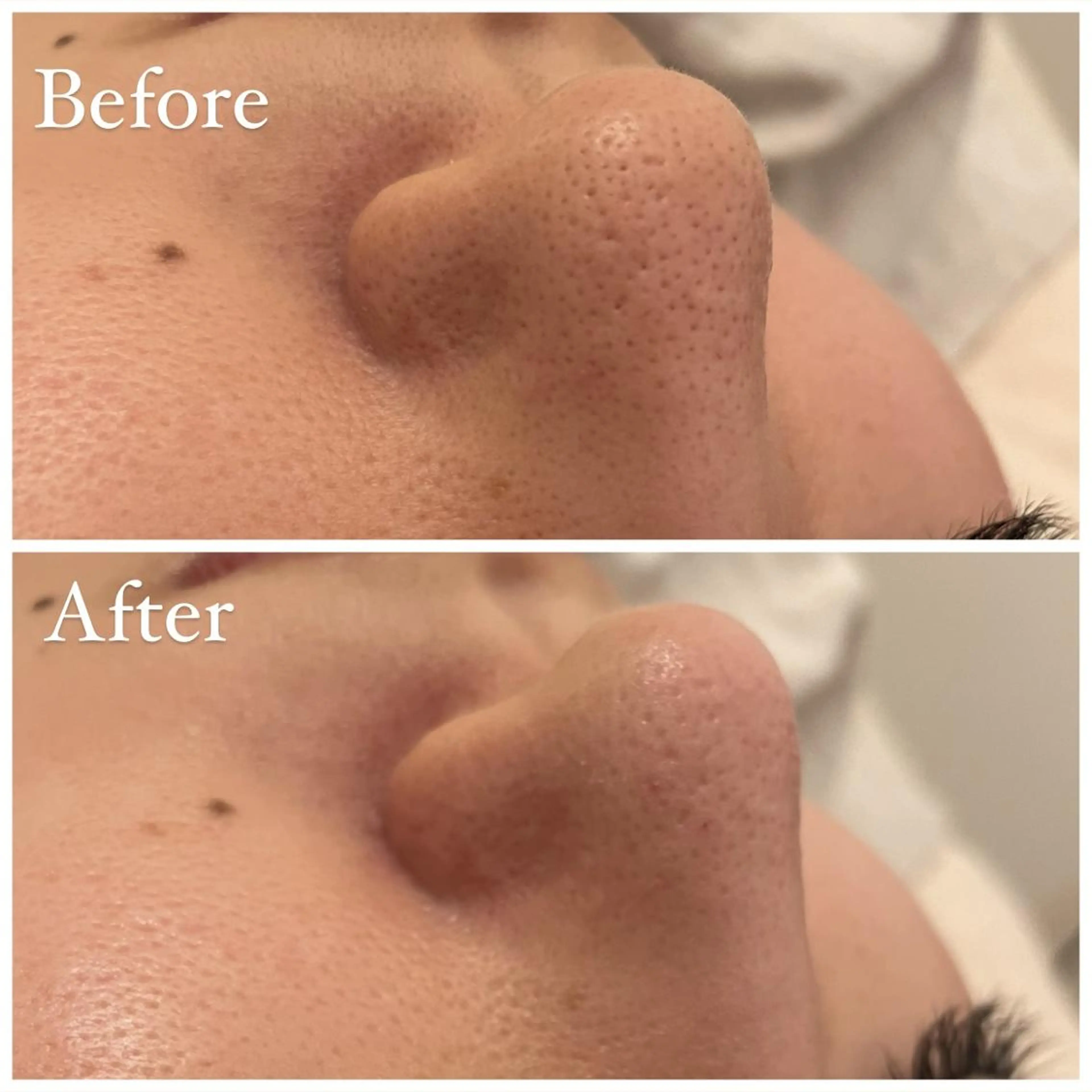 エステ ララ/ハーブ メゾンリュバンのエステ・リラクイメージ