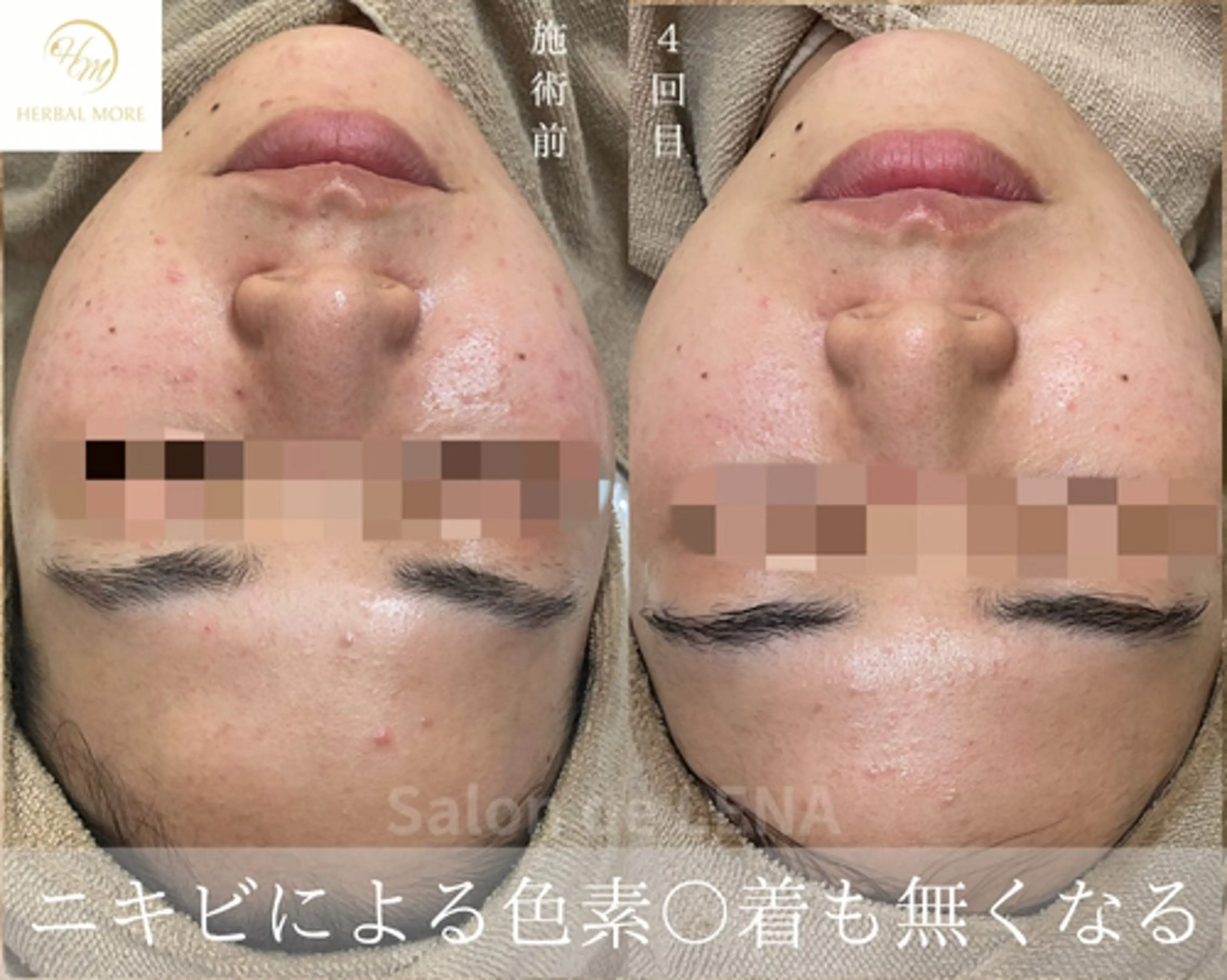 ハーブピーリング専門 サロンドレナ　白藤のエステ・リラクイメージ