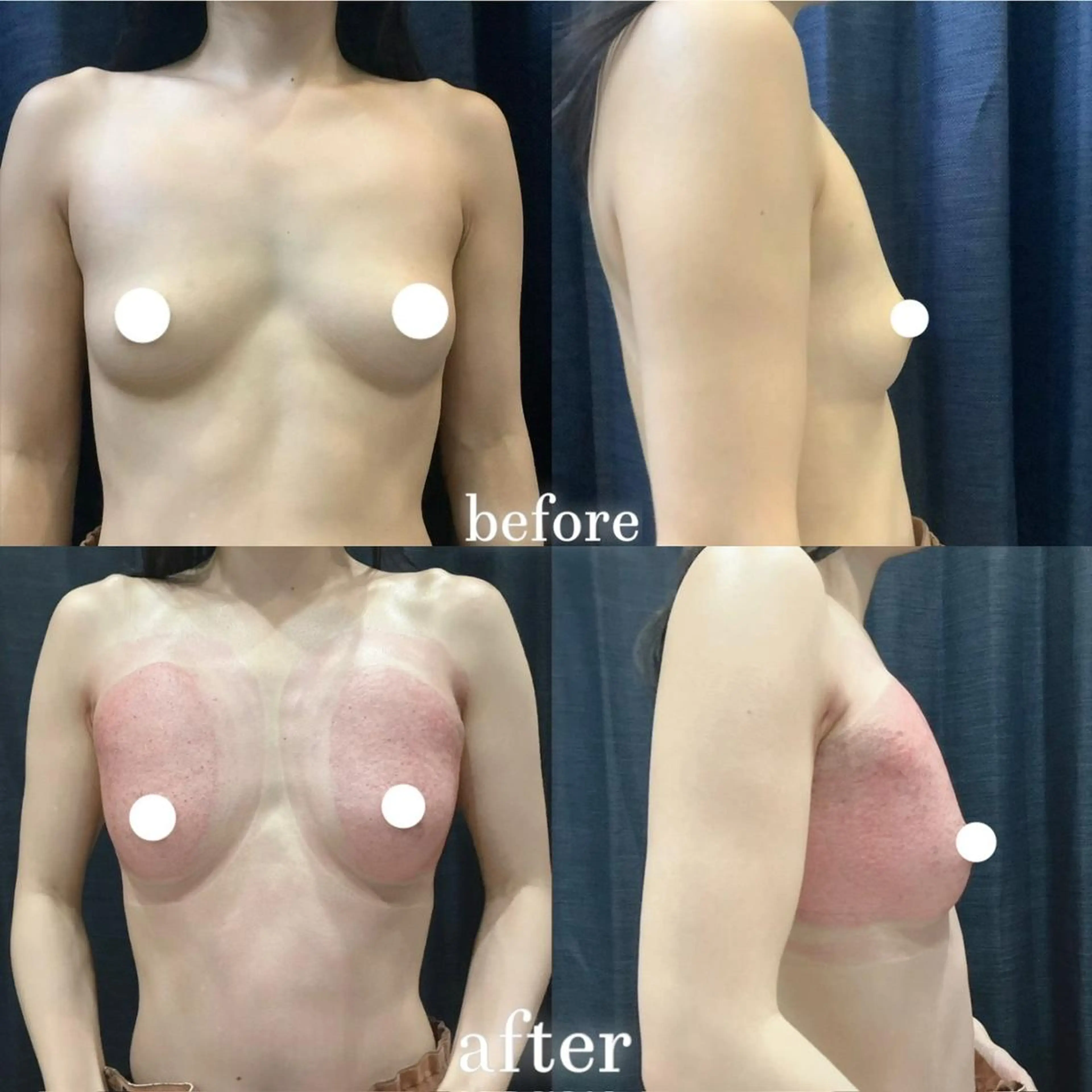 エルフラージュ 銀座店のエステ・リラクイメージ