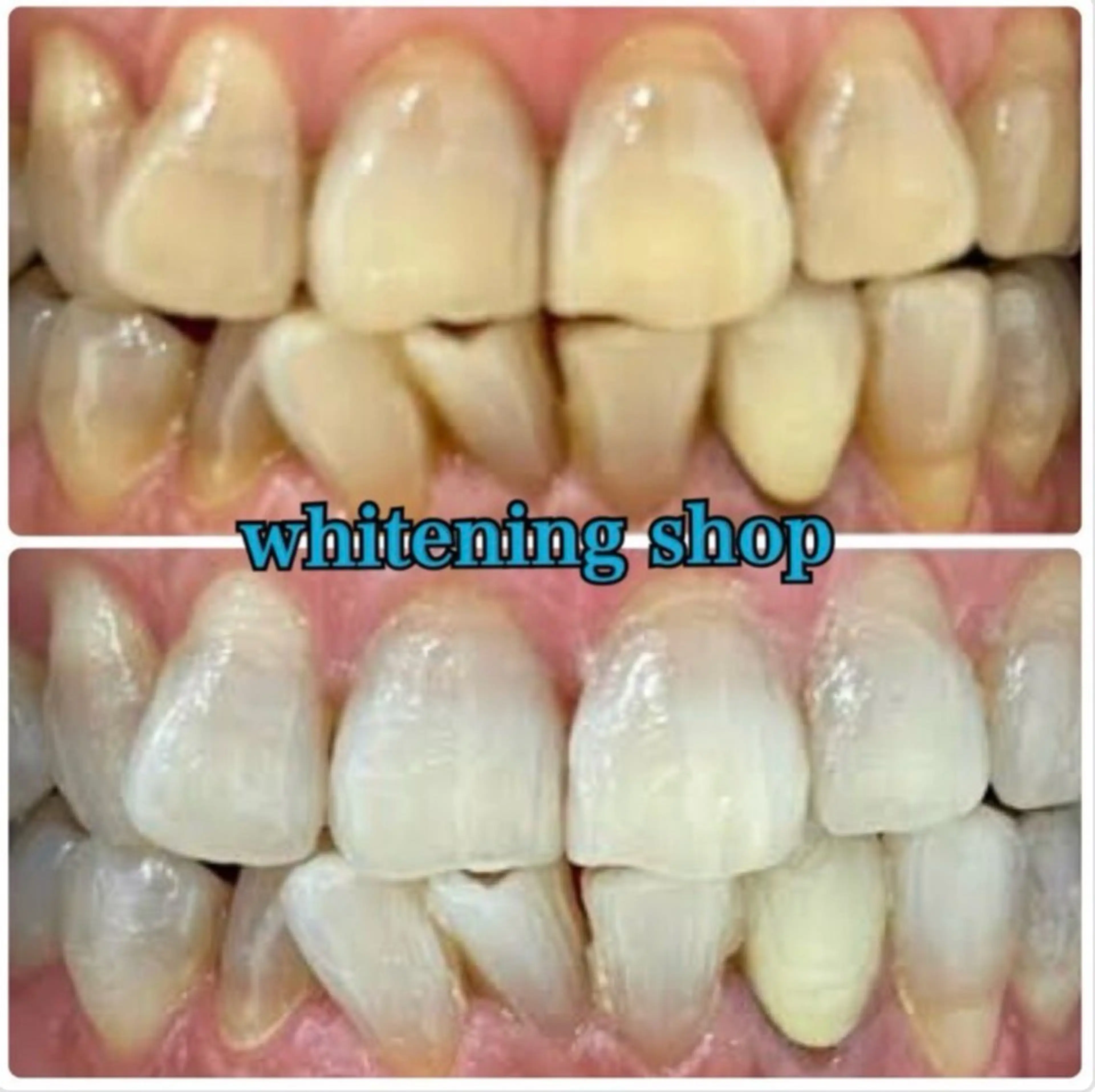 その他 ホワイトニング ショップ津店のその他イメージ