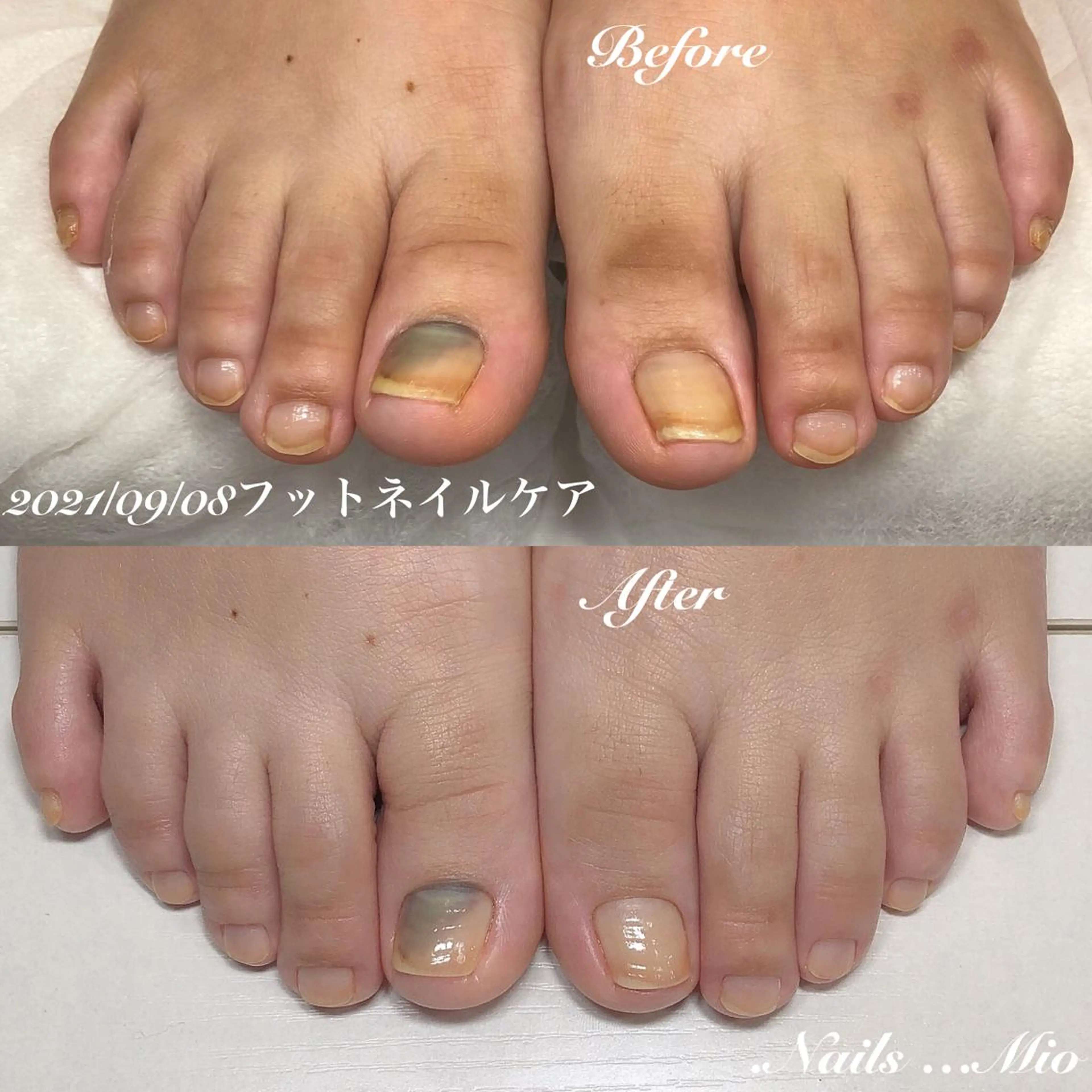ネイル フットネイル .Nails Mio 赤羽西ネイルサロンのネイルデザイン