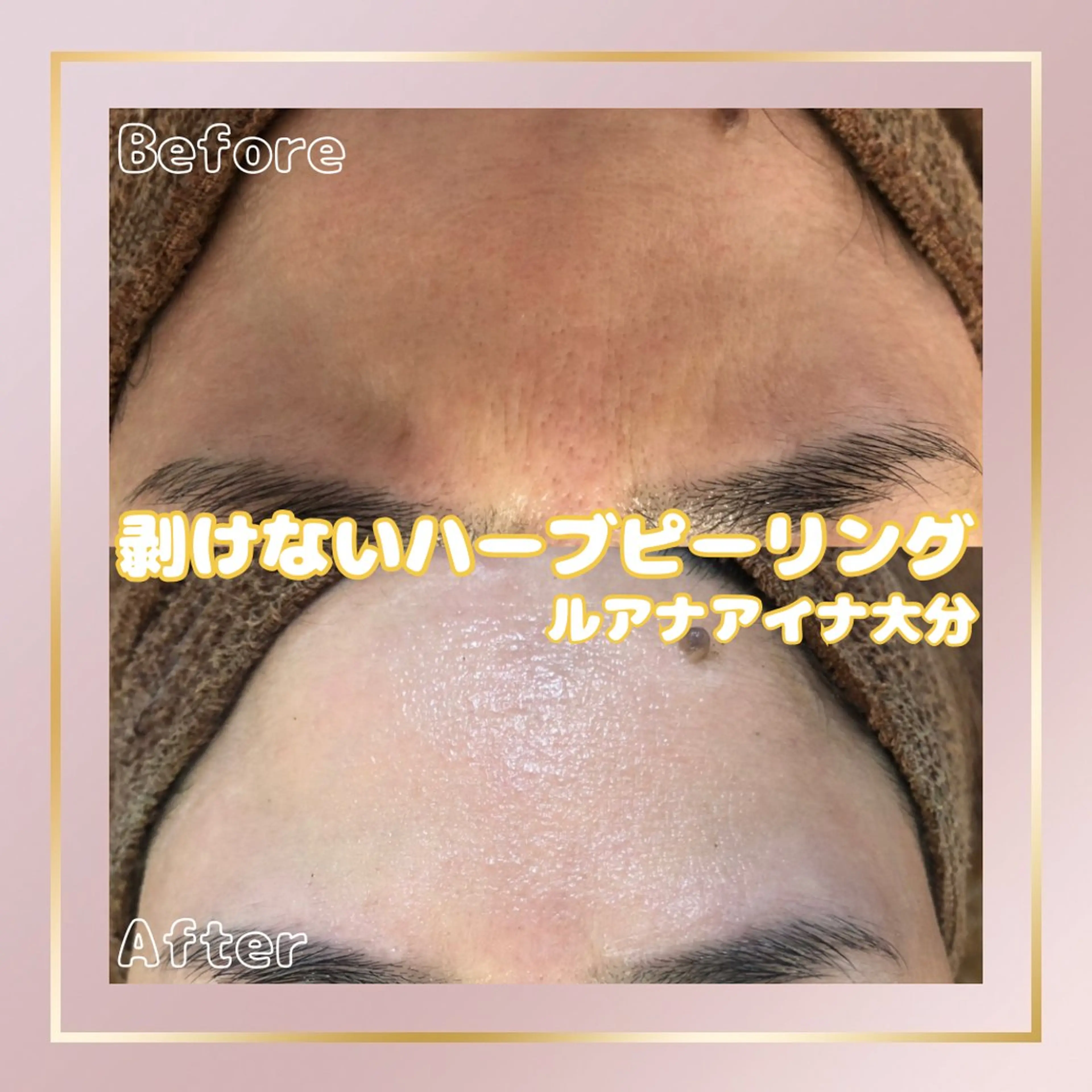 ルアナアイナ 大分のエステ・リラクイメージ