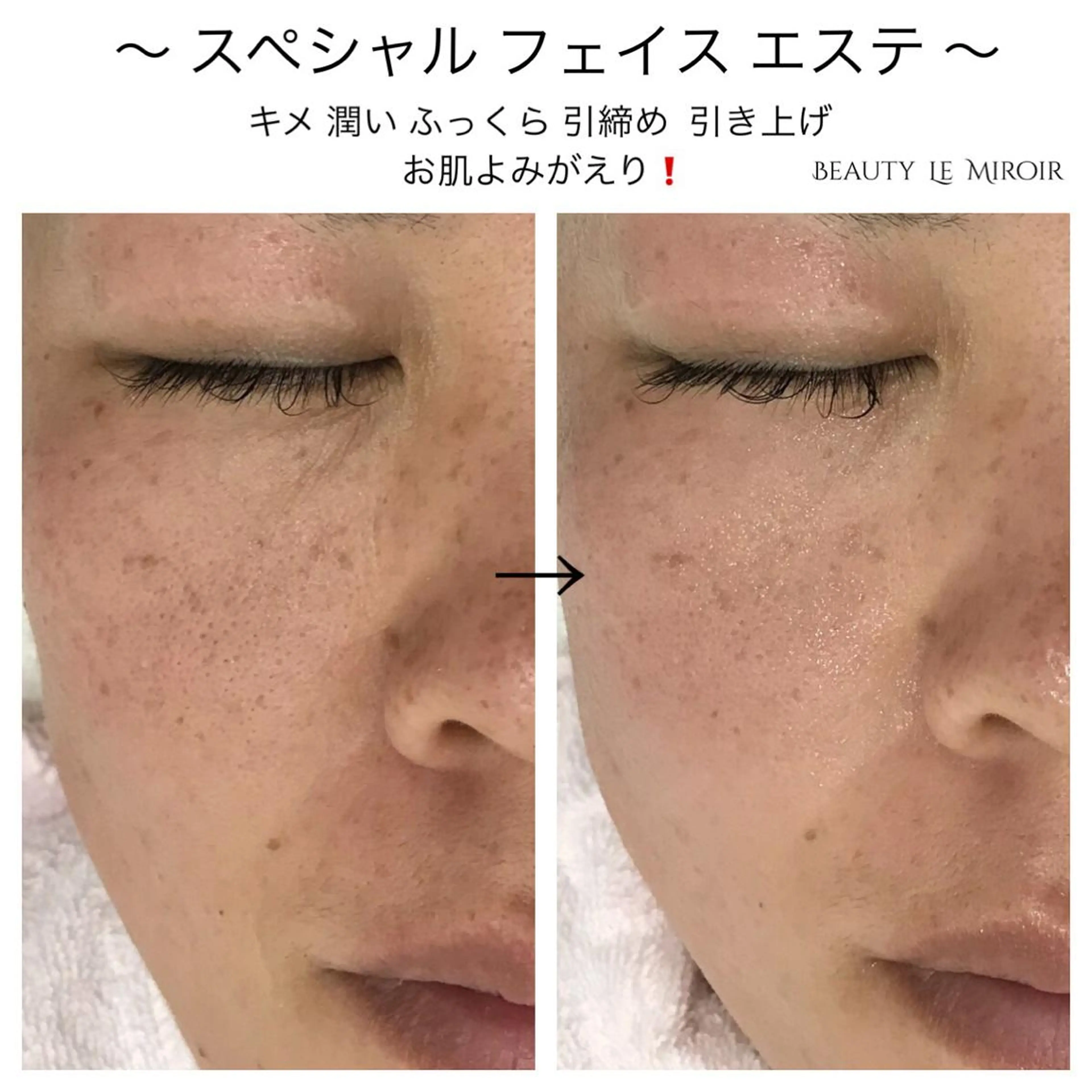 ビューティー ミロワールのエステ・リラクイメージ