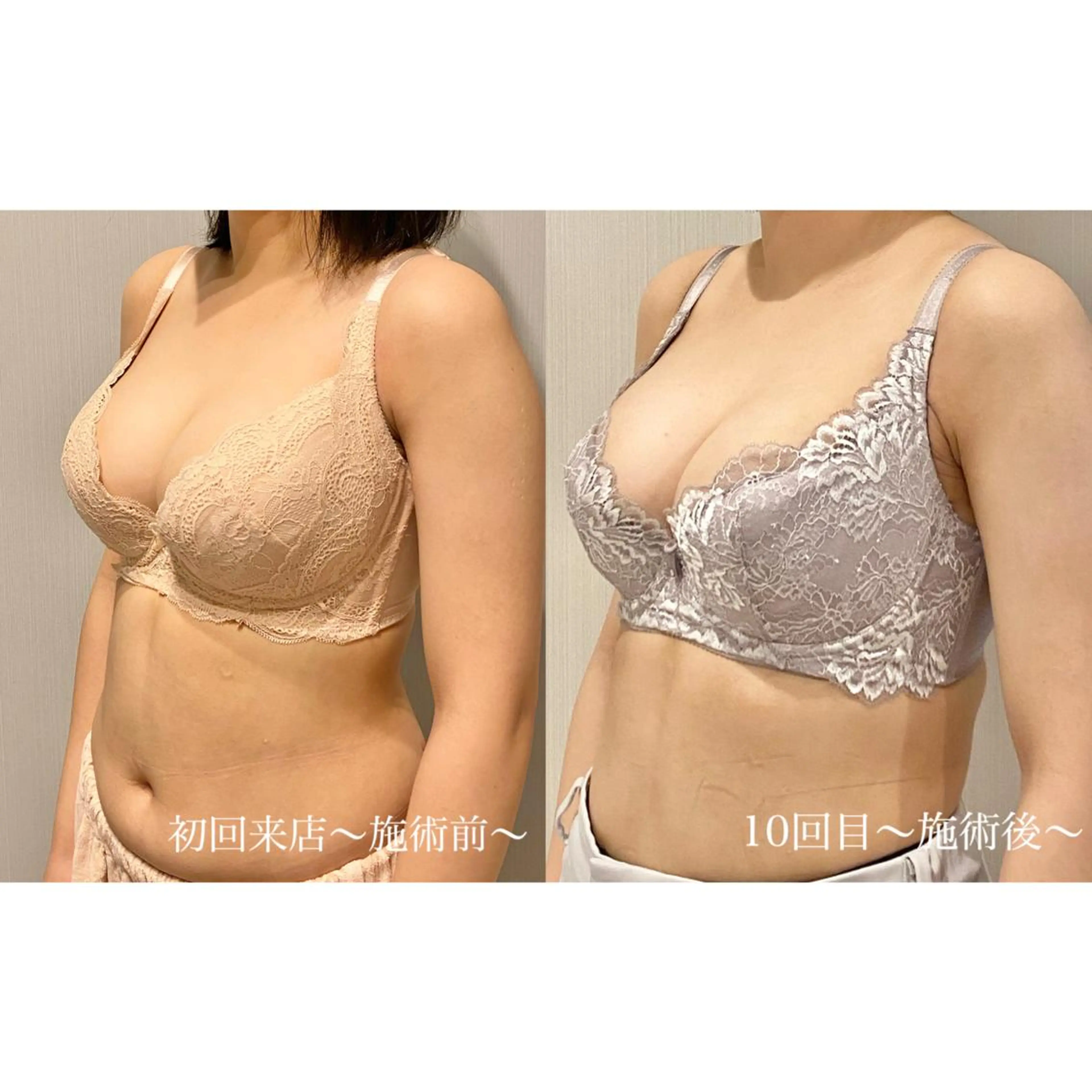 エステ リラク バストアップ専門店 Ti Amoのエステ・リラクイメージ