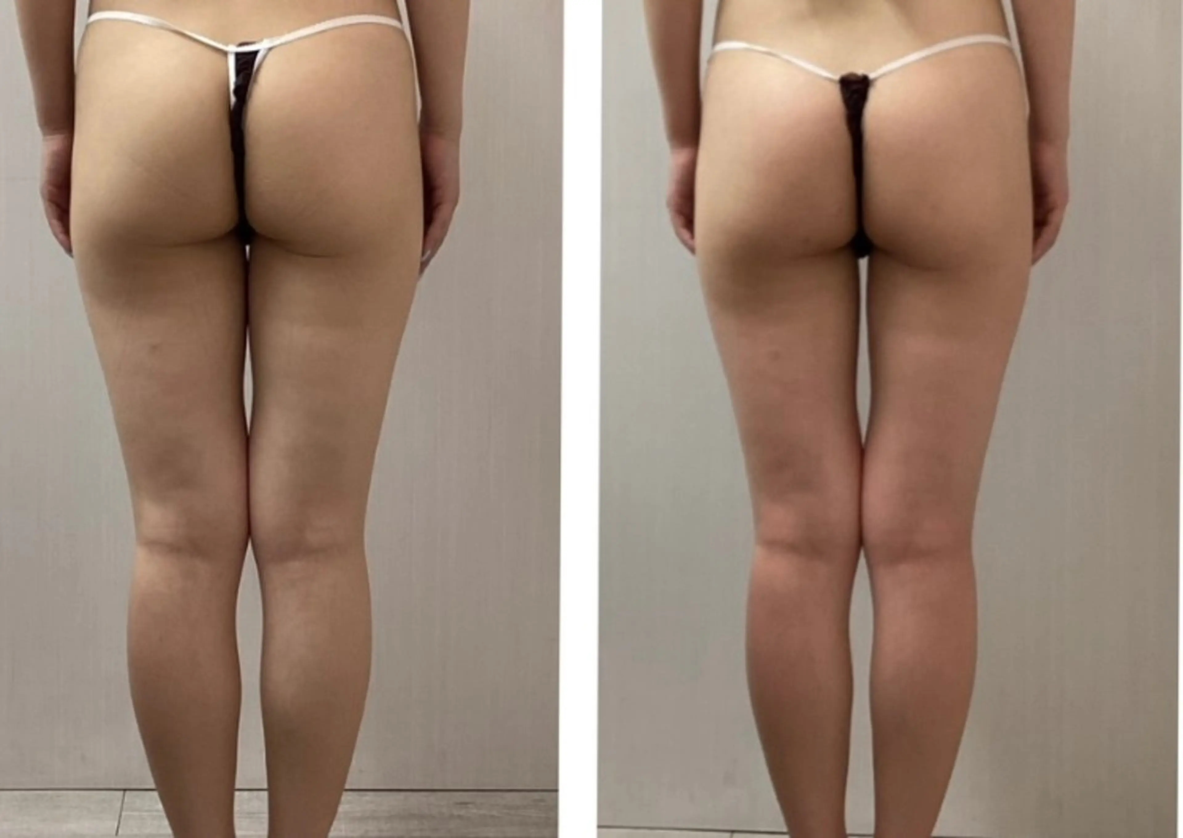 💕【即効】小顔コルギ+【強力】キャビテーション美脚70分💕憧れの小顔＆ヘルシー/スラリ美脚をご一緒に手に入れよう✨の写真