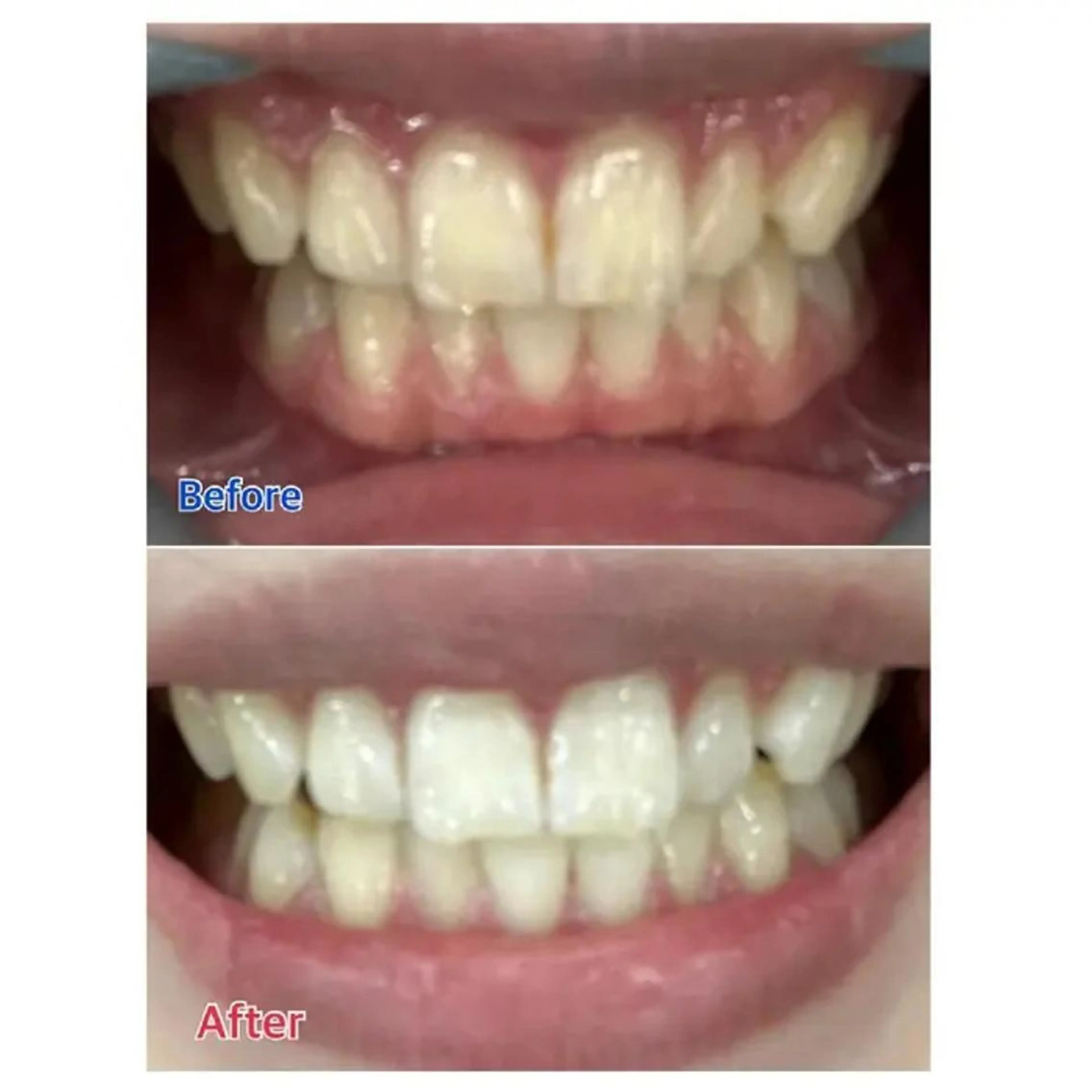 Ｍ渋谷 ホワイトニングのエステ・リラクイメージ