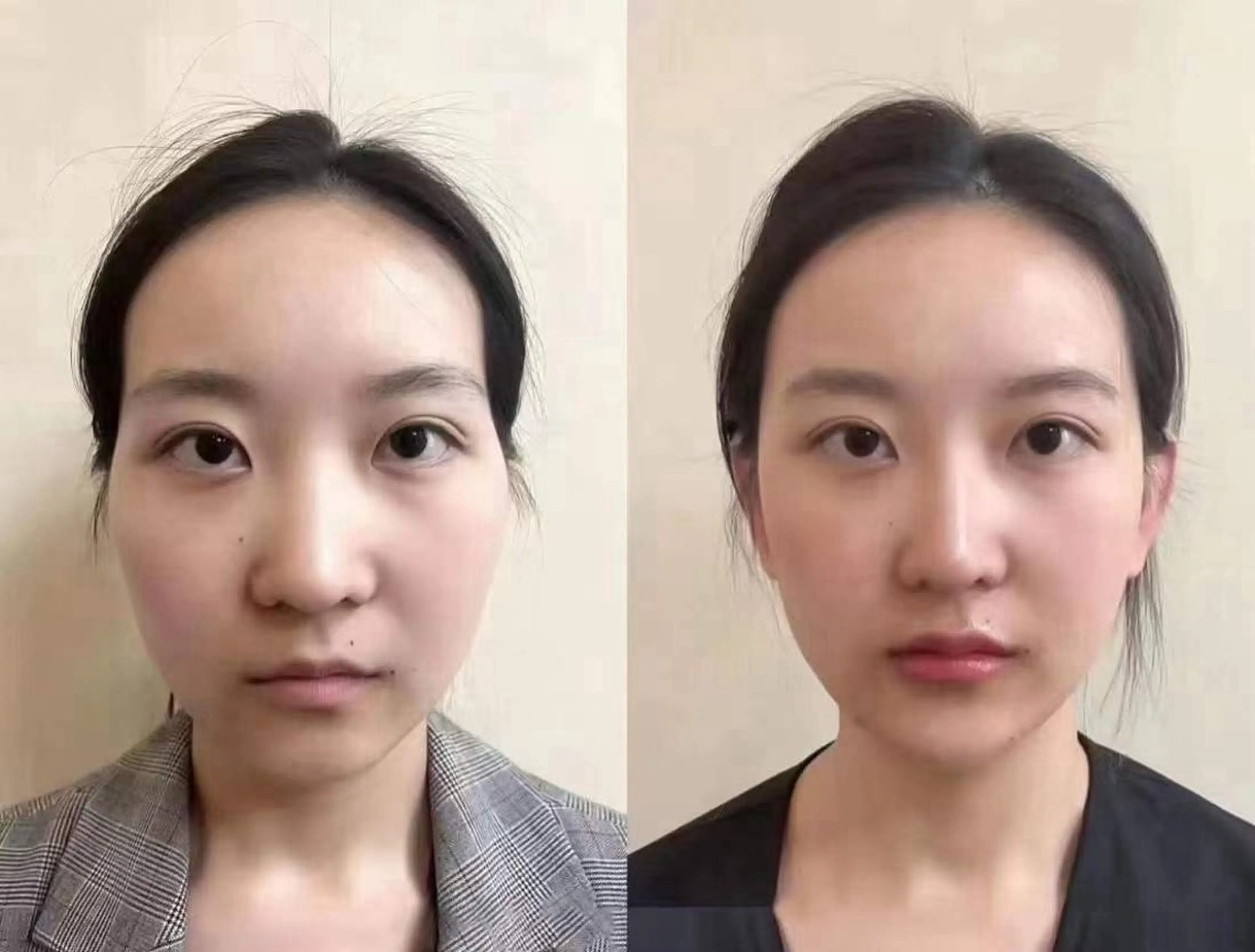 ネイル エステ aliaハイフ&水光ジェットサロン所属・aliaハーブ水光店 エステティシャン募集のエステ・リラクイメージ