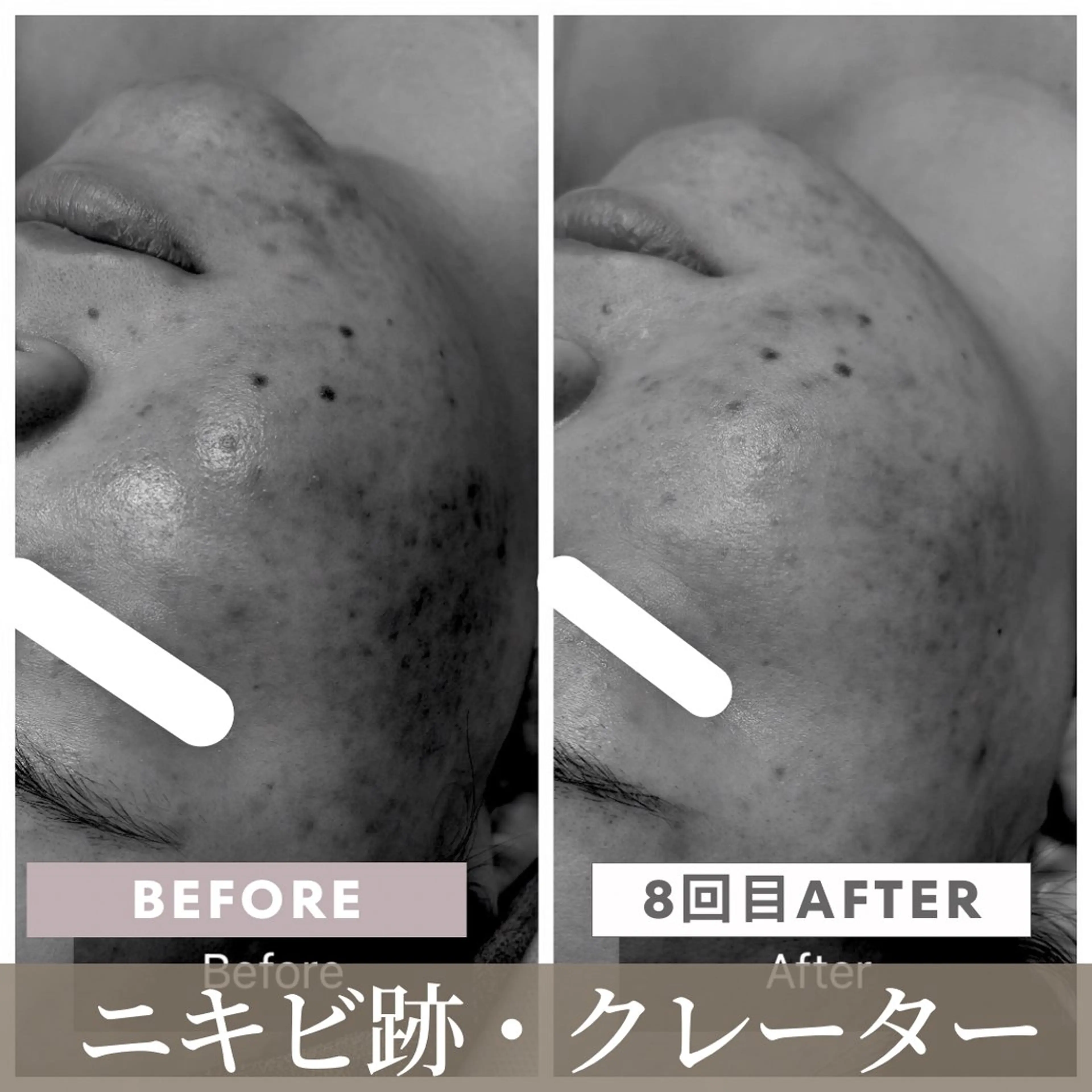 小顔矯正専門店 【RED】池田のエステ・リラクイメージ