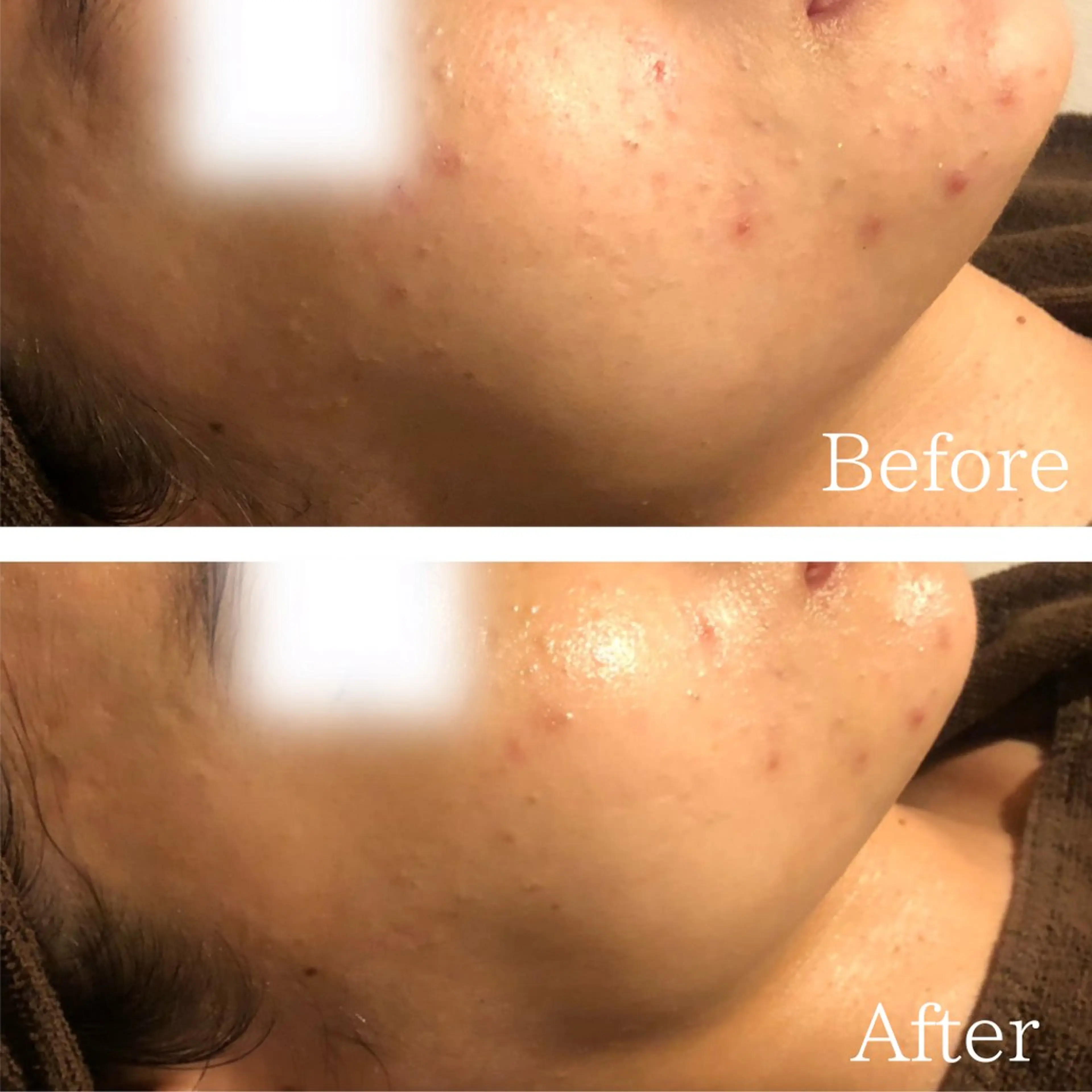 エステ 痩身専門サロン ビューティーグランツのエステ・リラクイメージ